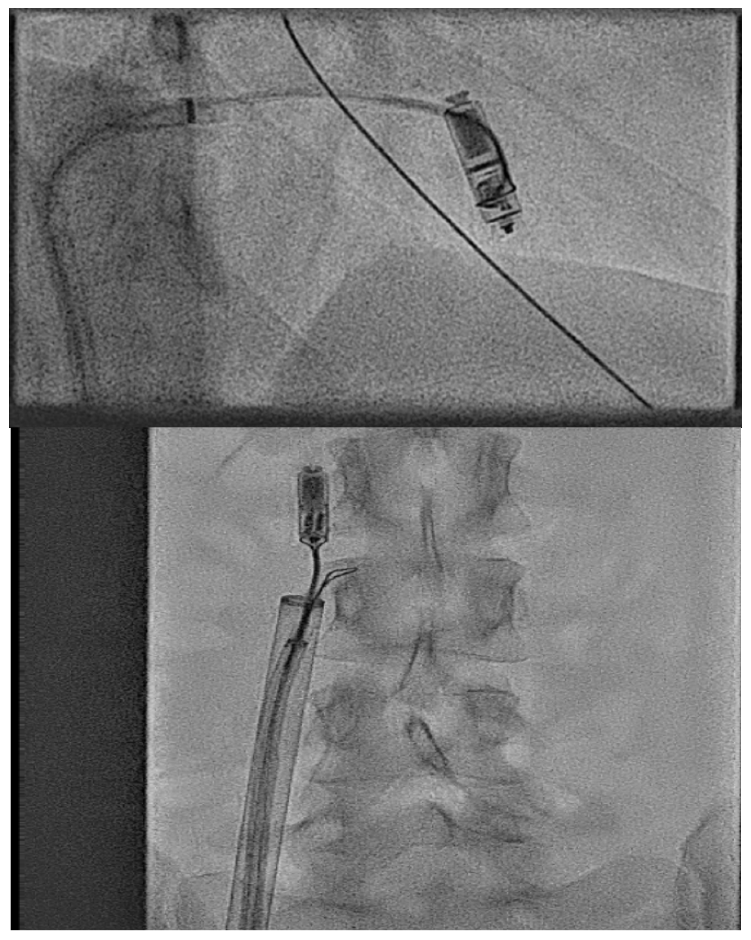 Jcm 14 08560 g003 Jcm 14 08560 g003