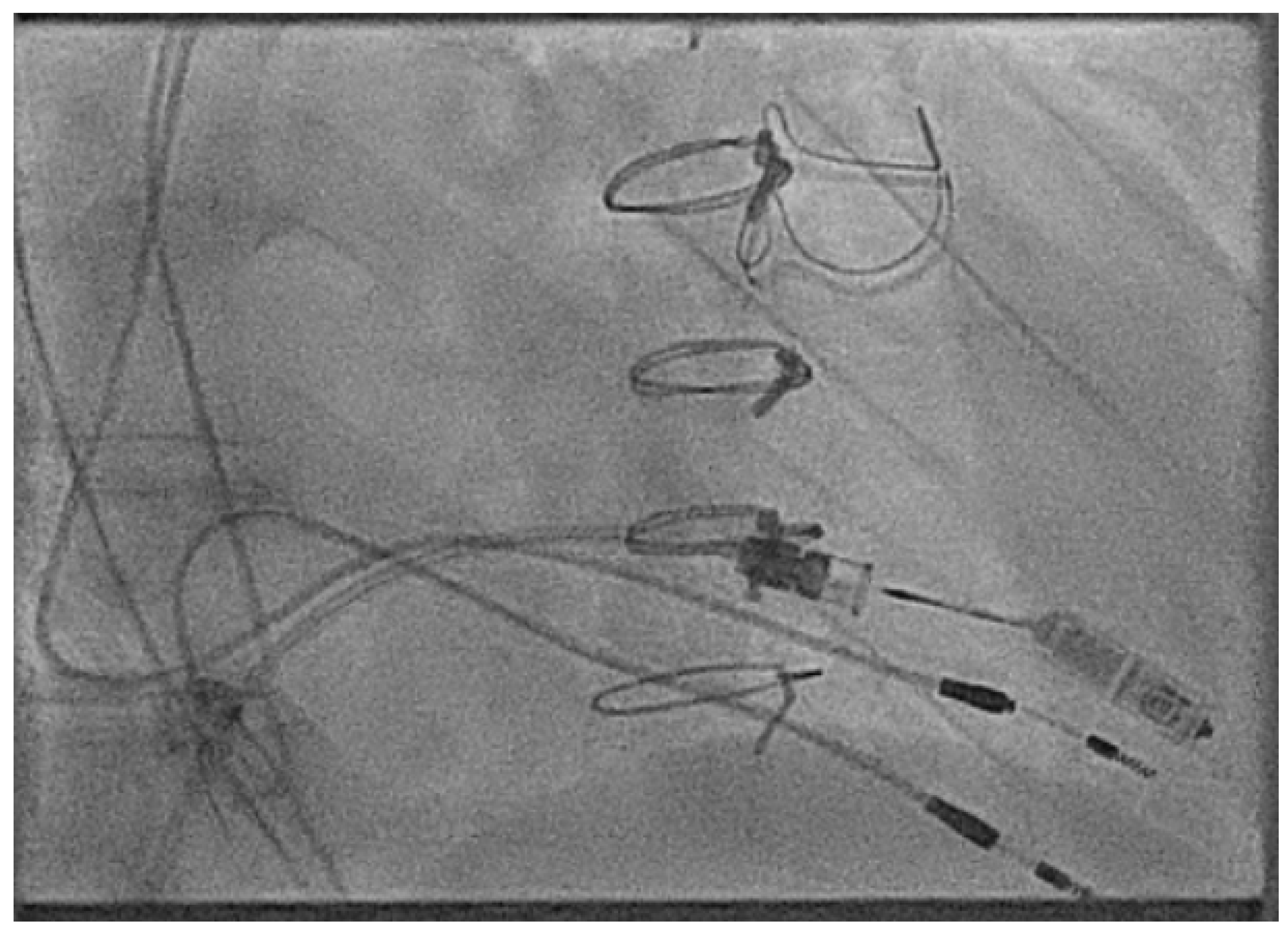 Jcm 14 08560 g004 Jcm 14 08560 g004