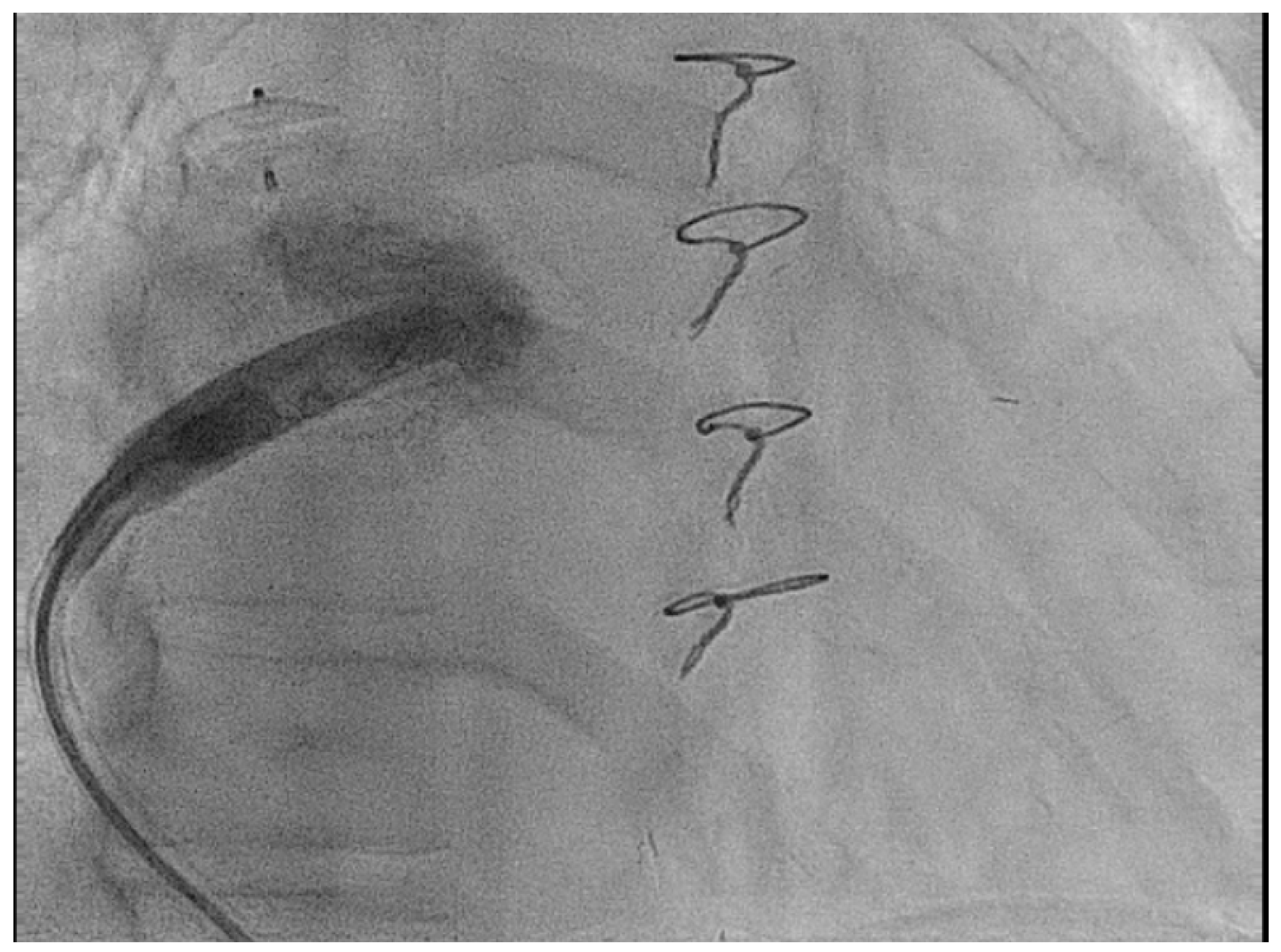 Jcm 14 08560 g005 Jcm 14 08560 g005