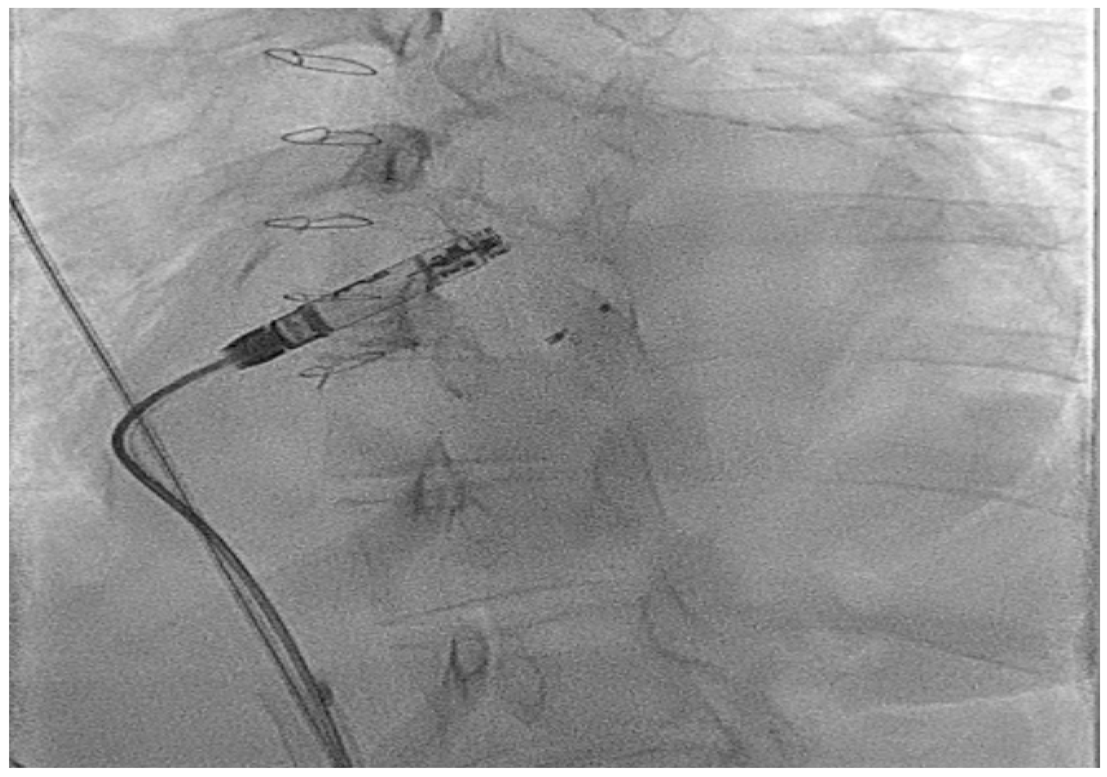 Jcm 14 08560 g006 Jcm 14 08560 g006