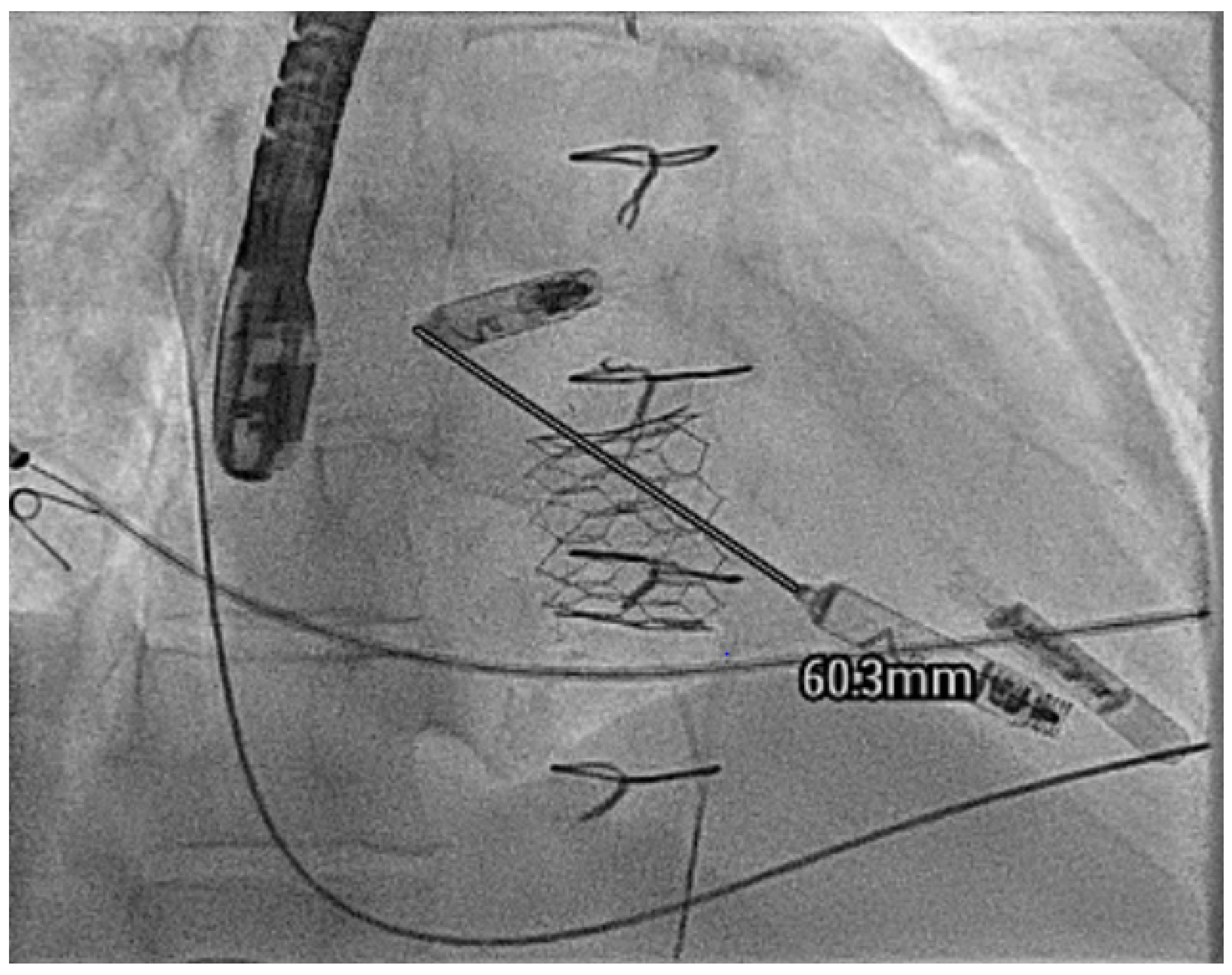 Jcm 14 08560 g007 Jcm 14 08560 g007