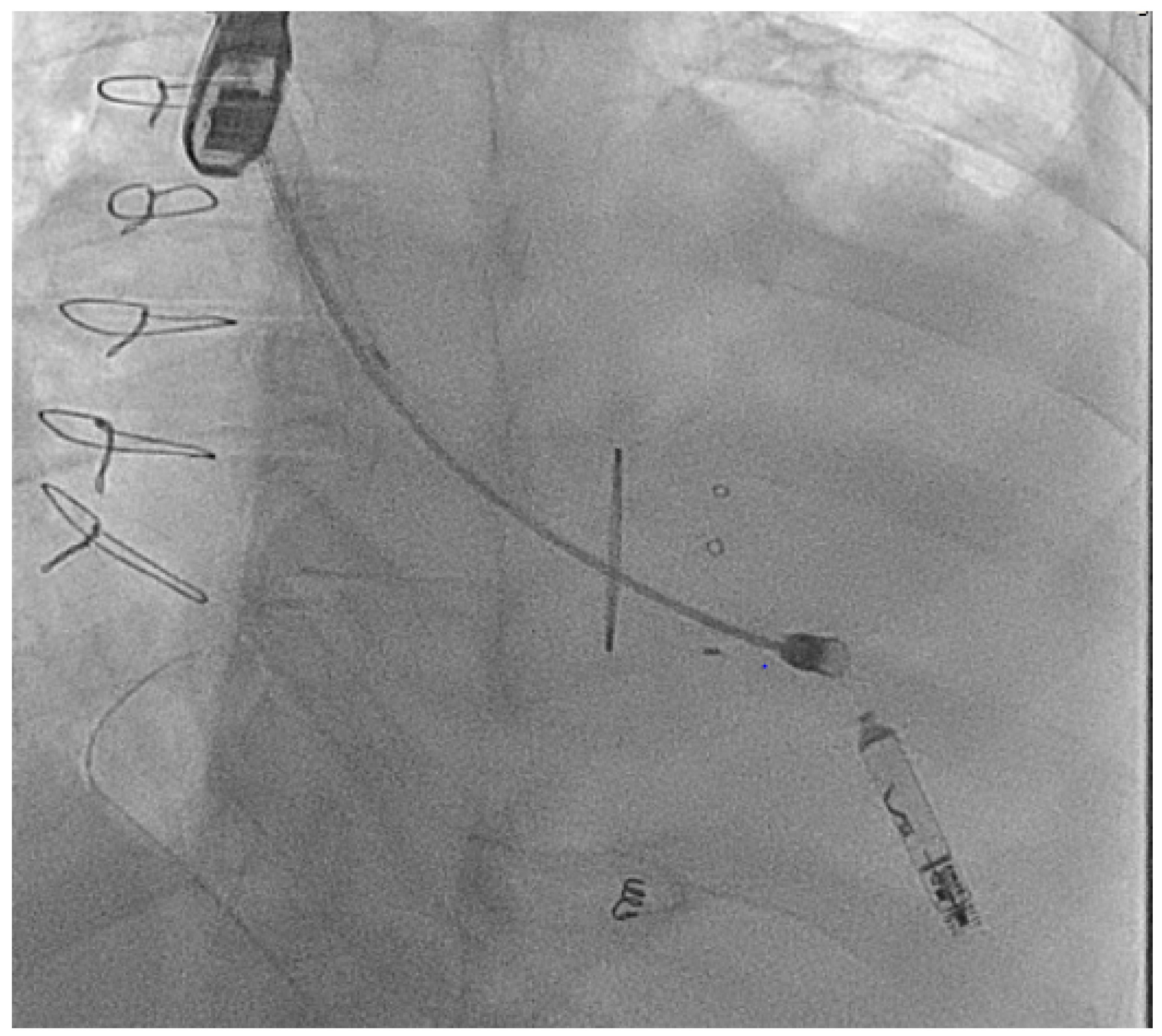 Jcm 14 08560 g009 Jcm 14 08560 g009