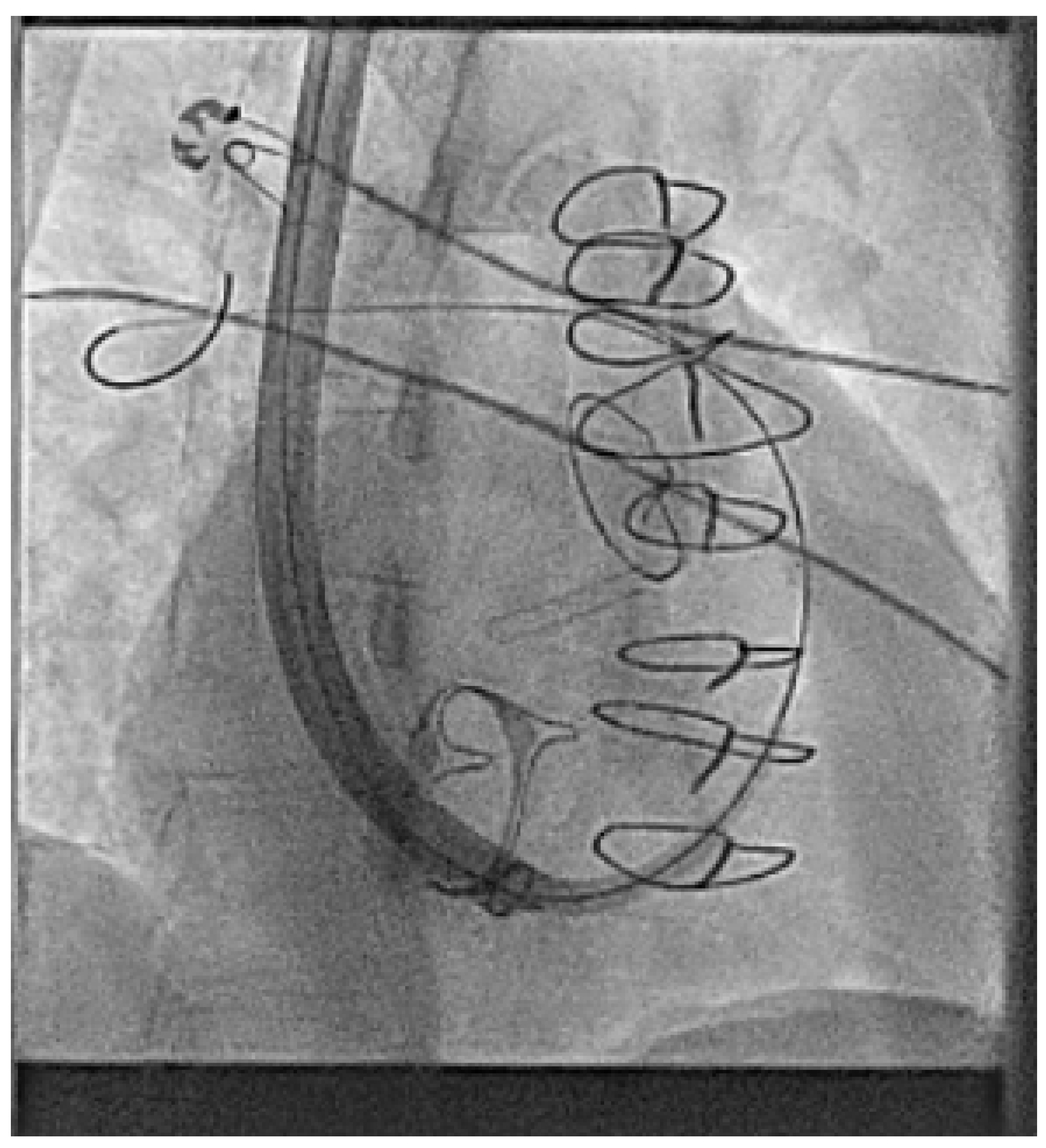 Jcm 14 08560 g010 Jcm 14 08560 g010