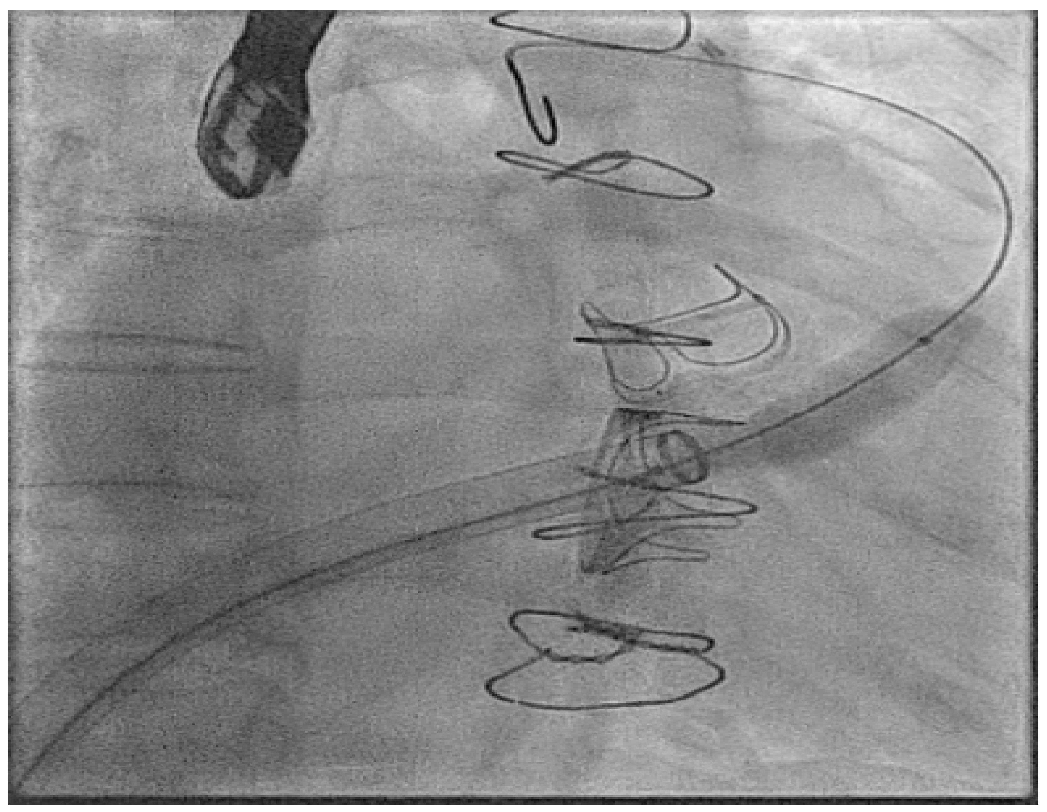 Jcm 14 08560 g011 Jcm 14 08560 g011