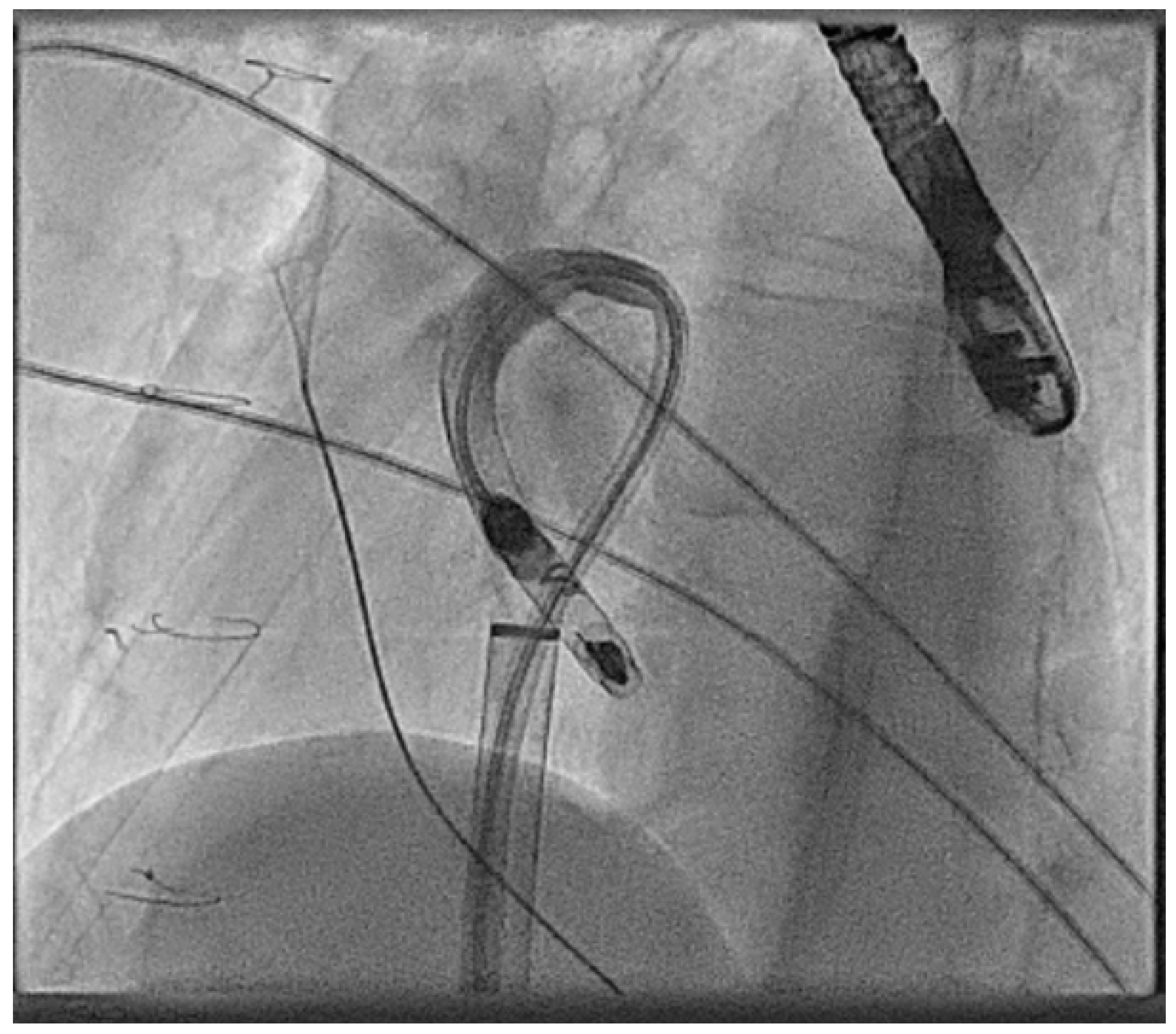 Jcm 14 08560 g014 Jcm 14 08560 g014