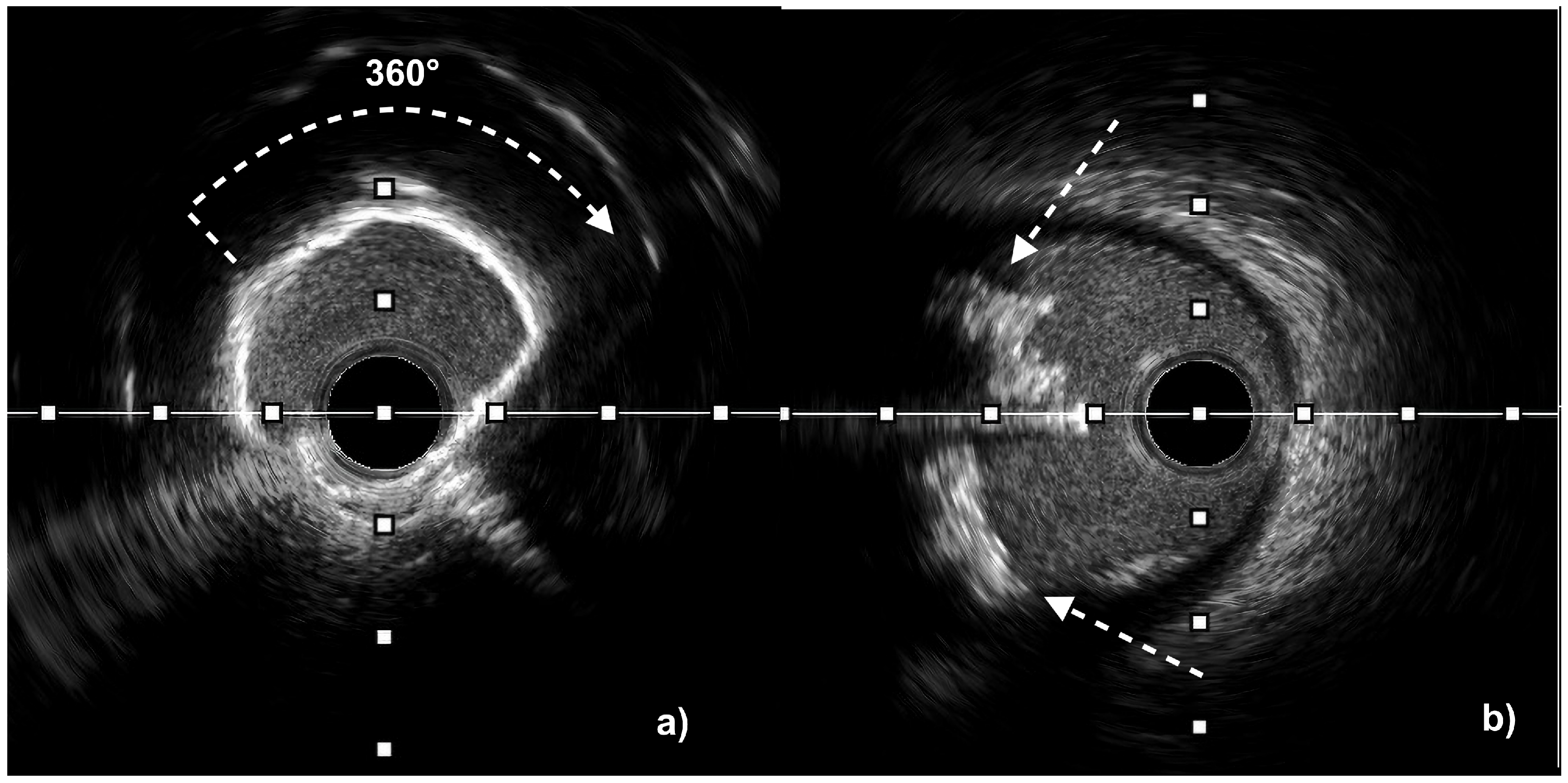 Jcm 14 08566 g001 Jcm 14 08566 g001