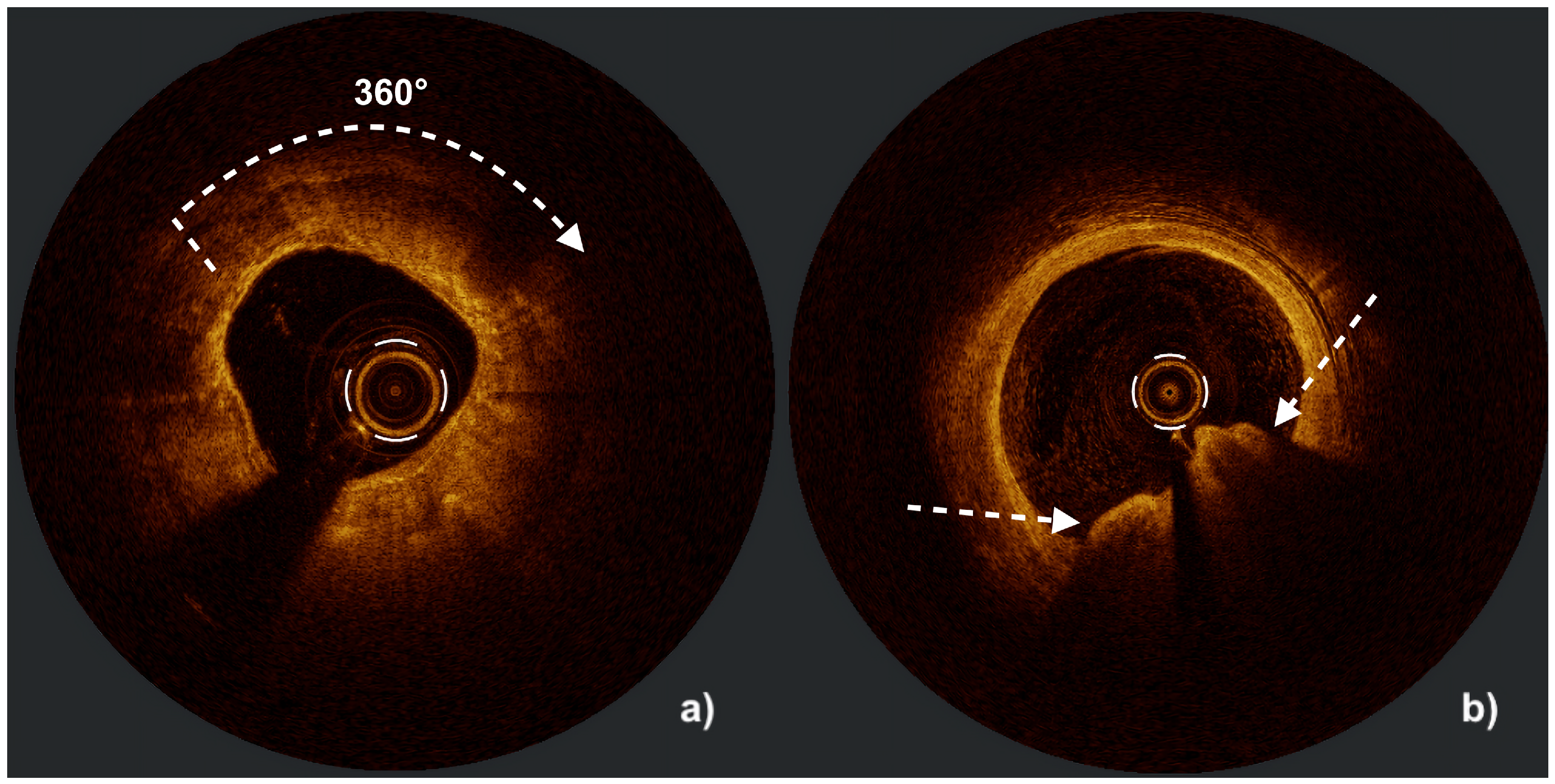 Jcm 14 08566 g002 Jcm 14 08566 g002