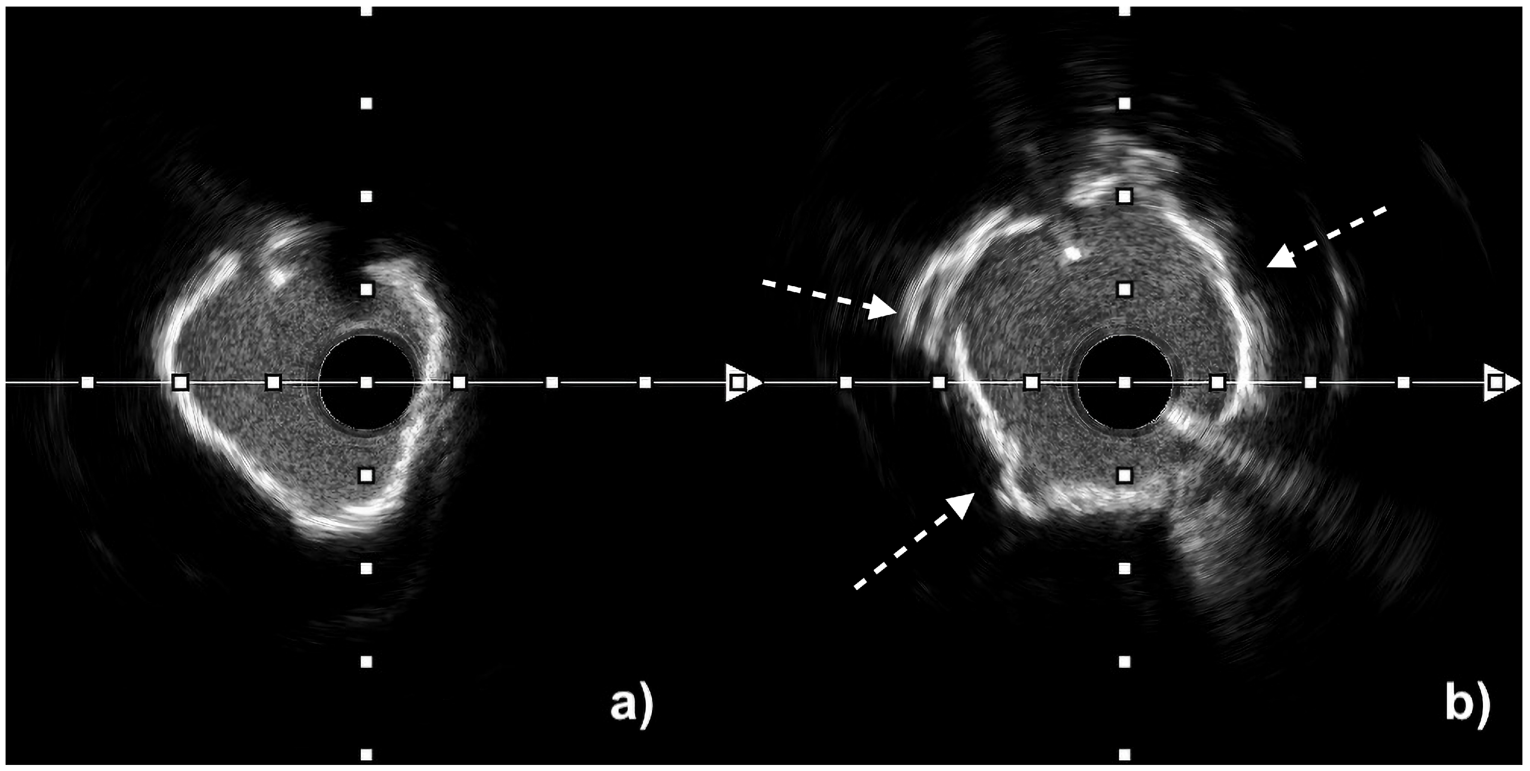 Jcm 14 08566 g003 Jcm 14 08566 g003
