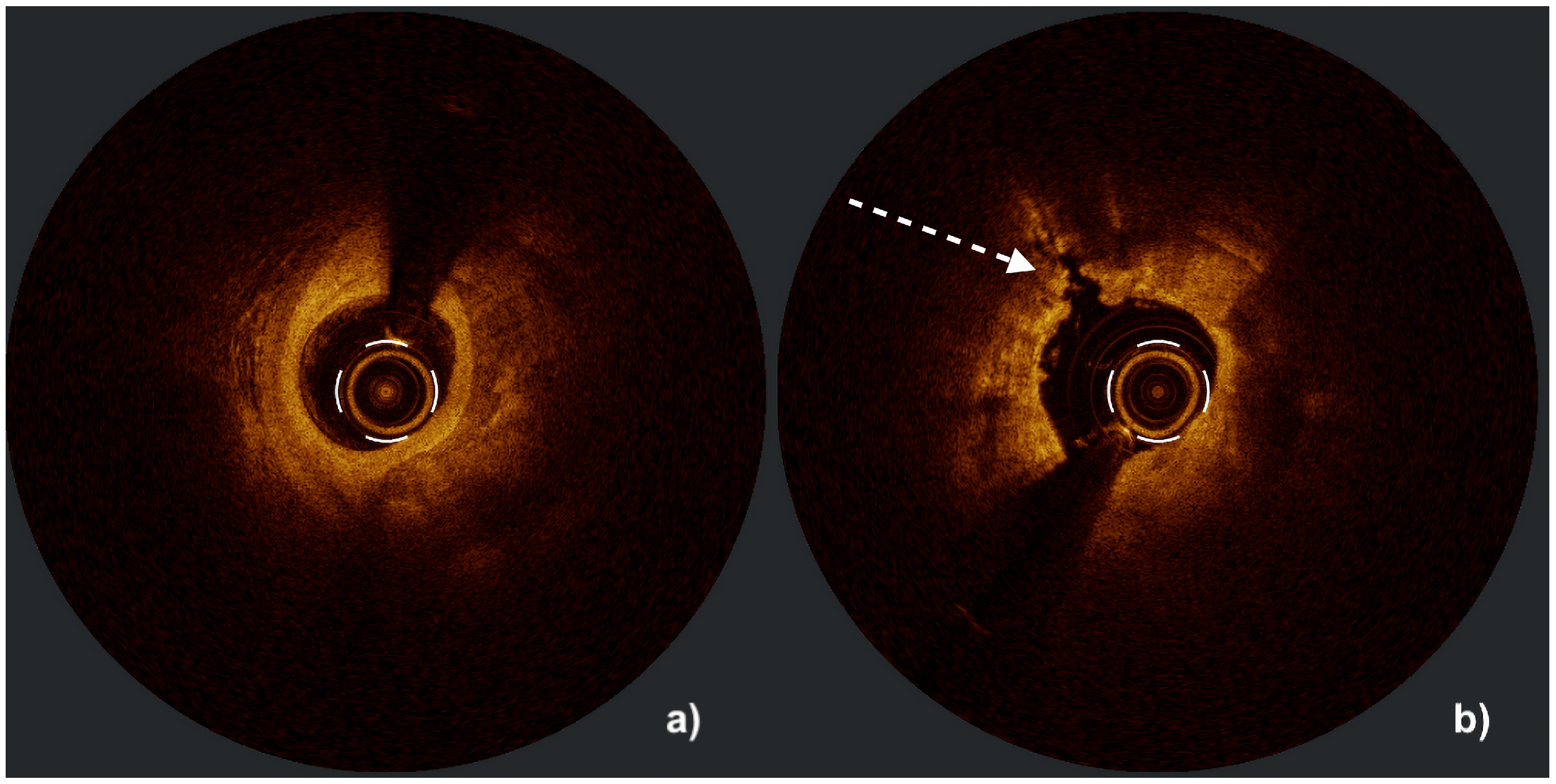 Jcm 14 08566 g004 Jcm 14 08566 g004