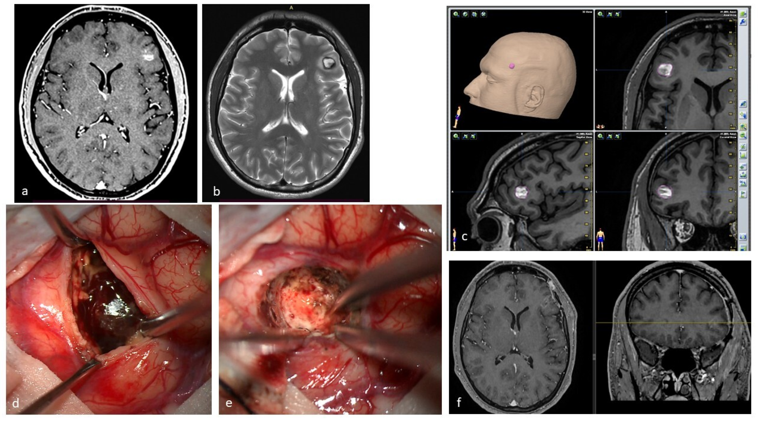 Jcm 14 08614 g003 Jcm 14 08614 g003