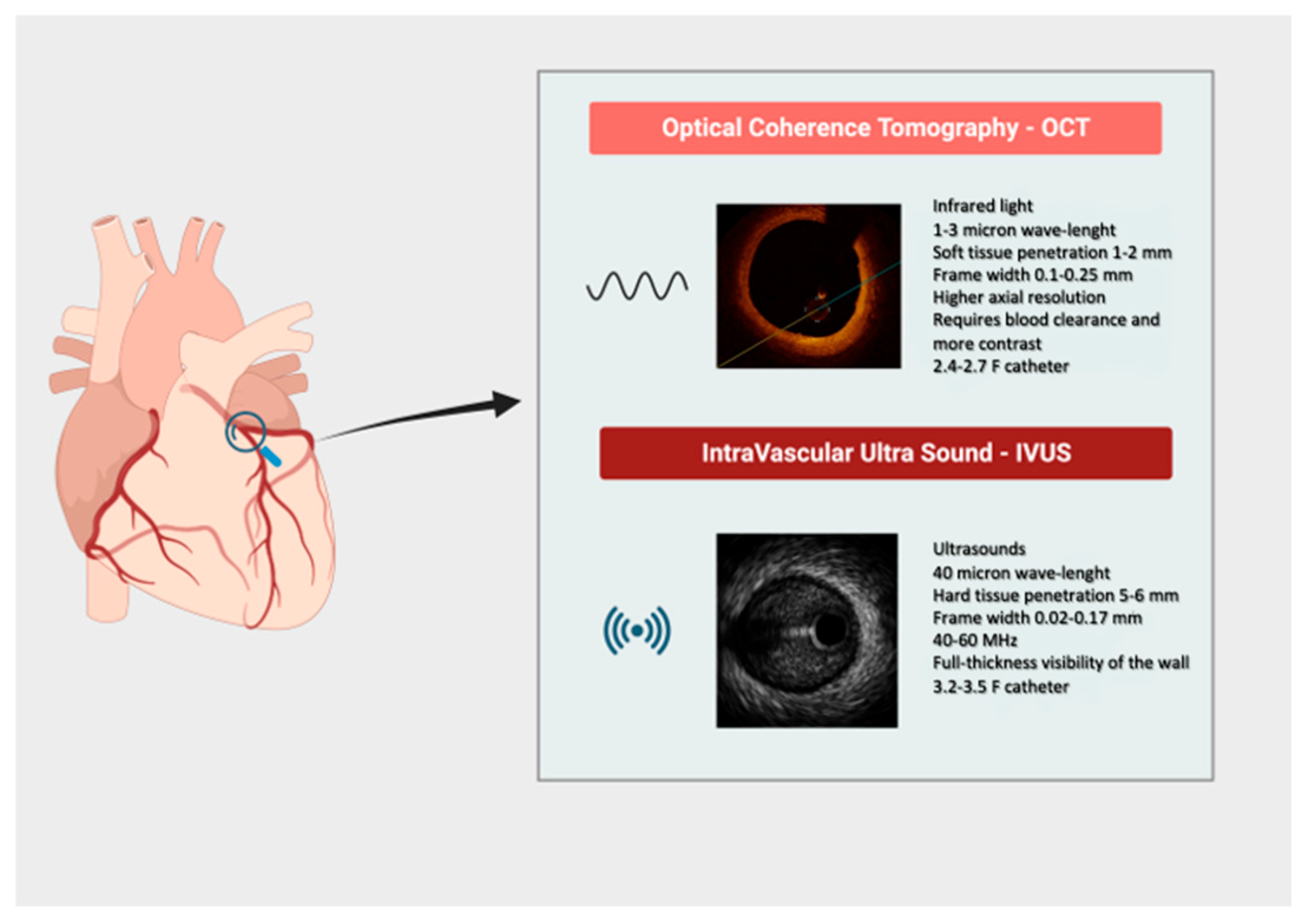 Modern Imaging Techniques for Percutaneous Coronary Intervention Guidance:  A Focus on Intravascular Ultrasound and Optical Coherence Tomography