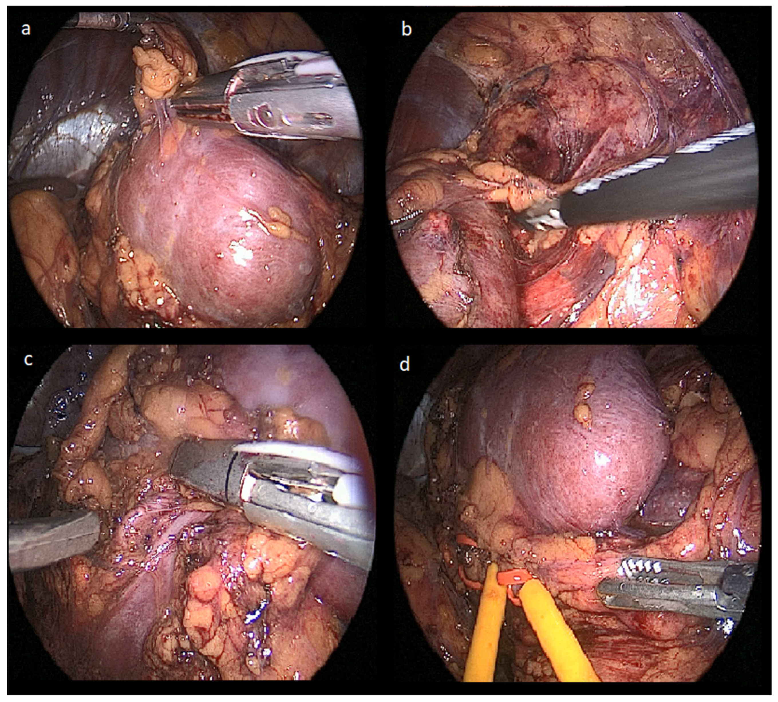 Jcm 14 08693 g002 Jcm 14 08693 g002