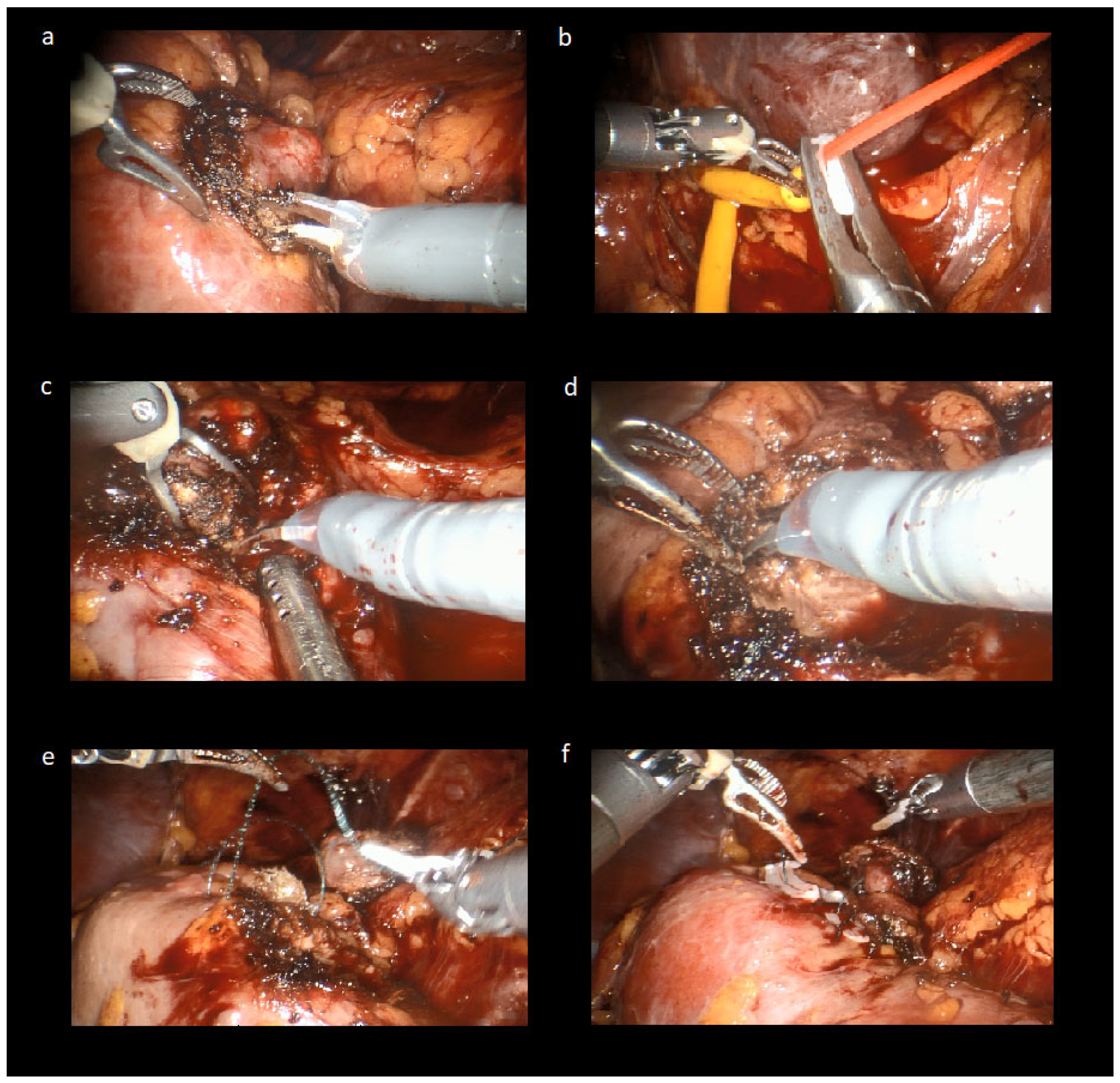 Jcm 14 08693 g003 Jcm 14 08693 g003