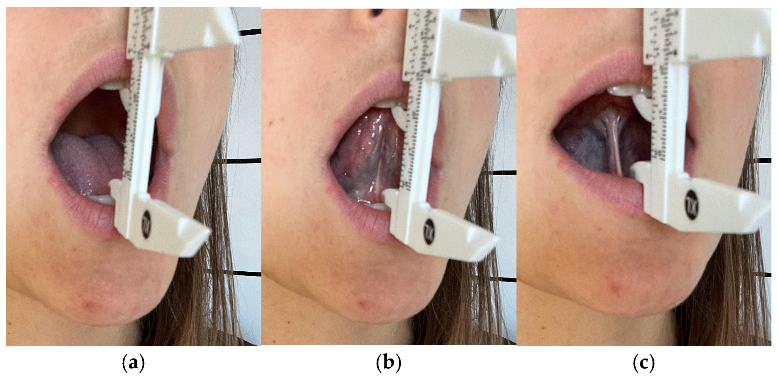 Jcm 14 08718 g004 Jcm 14 08718 g004