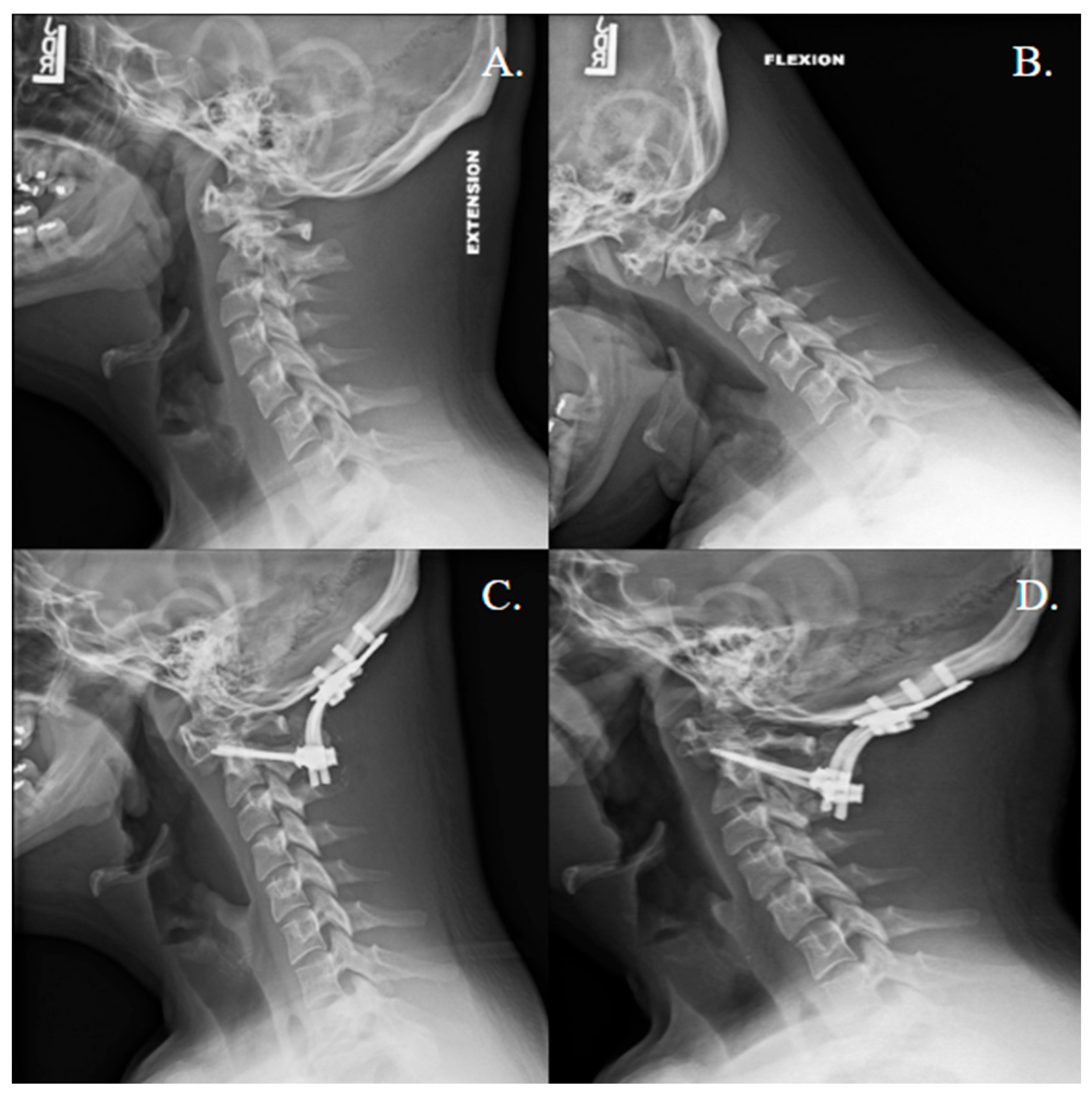 Jcm 14 08731 g002 Jcm 14 08731 g002