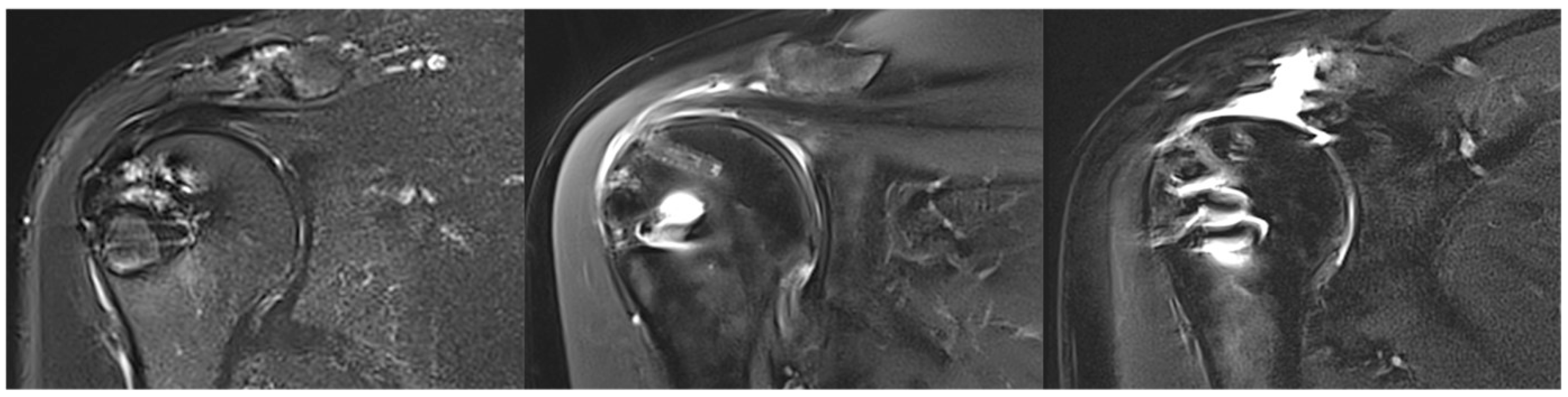 Jcm 14 08797 g004 Jcm 14 08797 g004