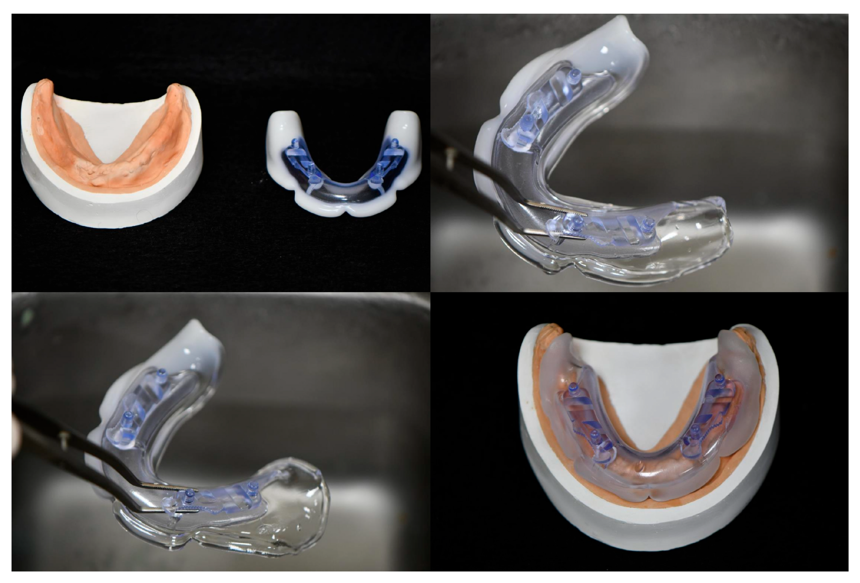 Jcm 14 08804 g003 Jcm 14 08804 g003