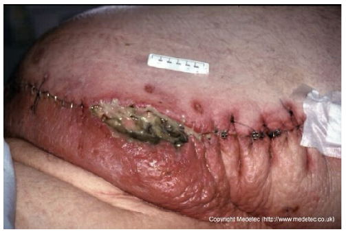 Jcm 14 08825 i010 Jcm 14 08825 i010