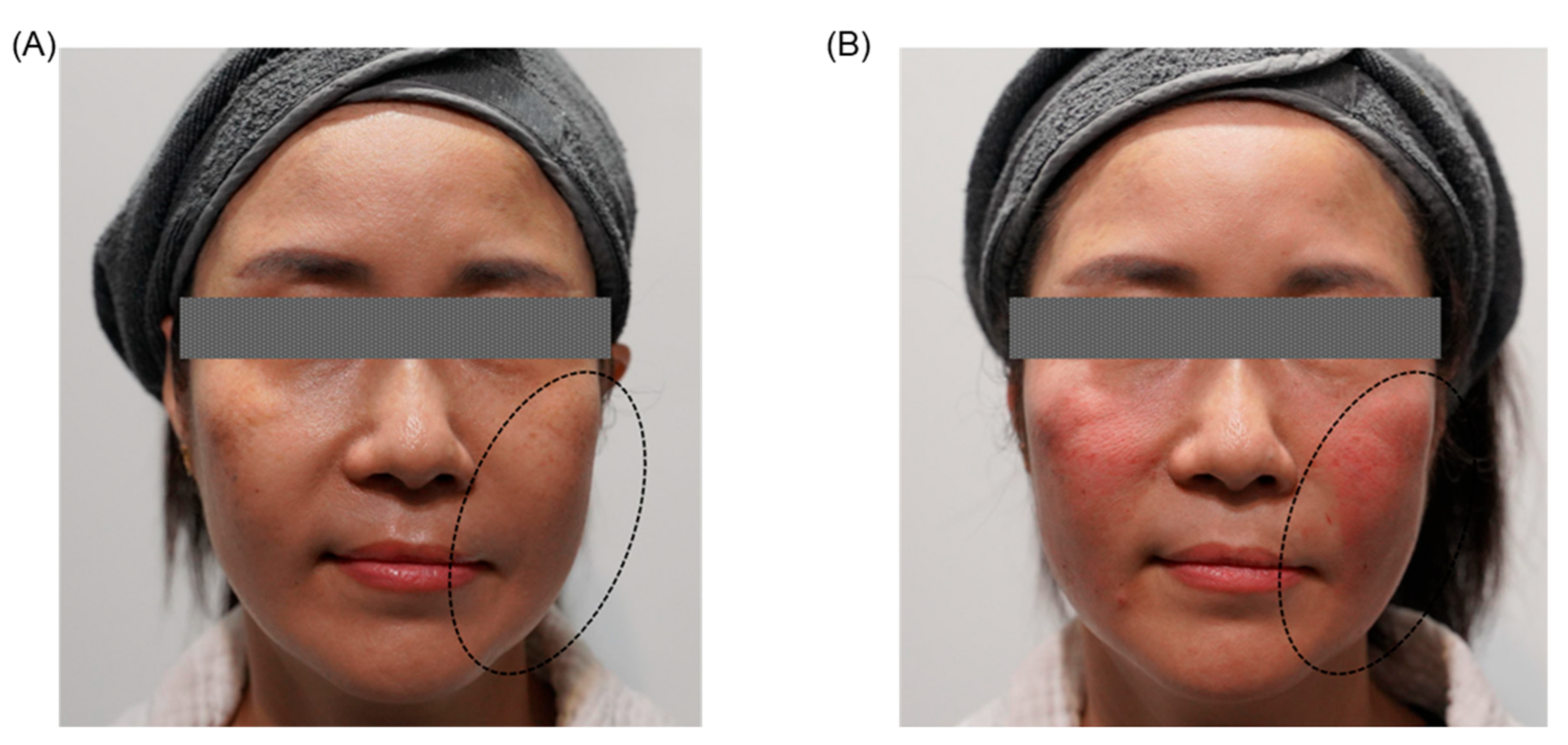 Jcm 14 08828 g002 Jcm 14 08828 g002