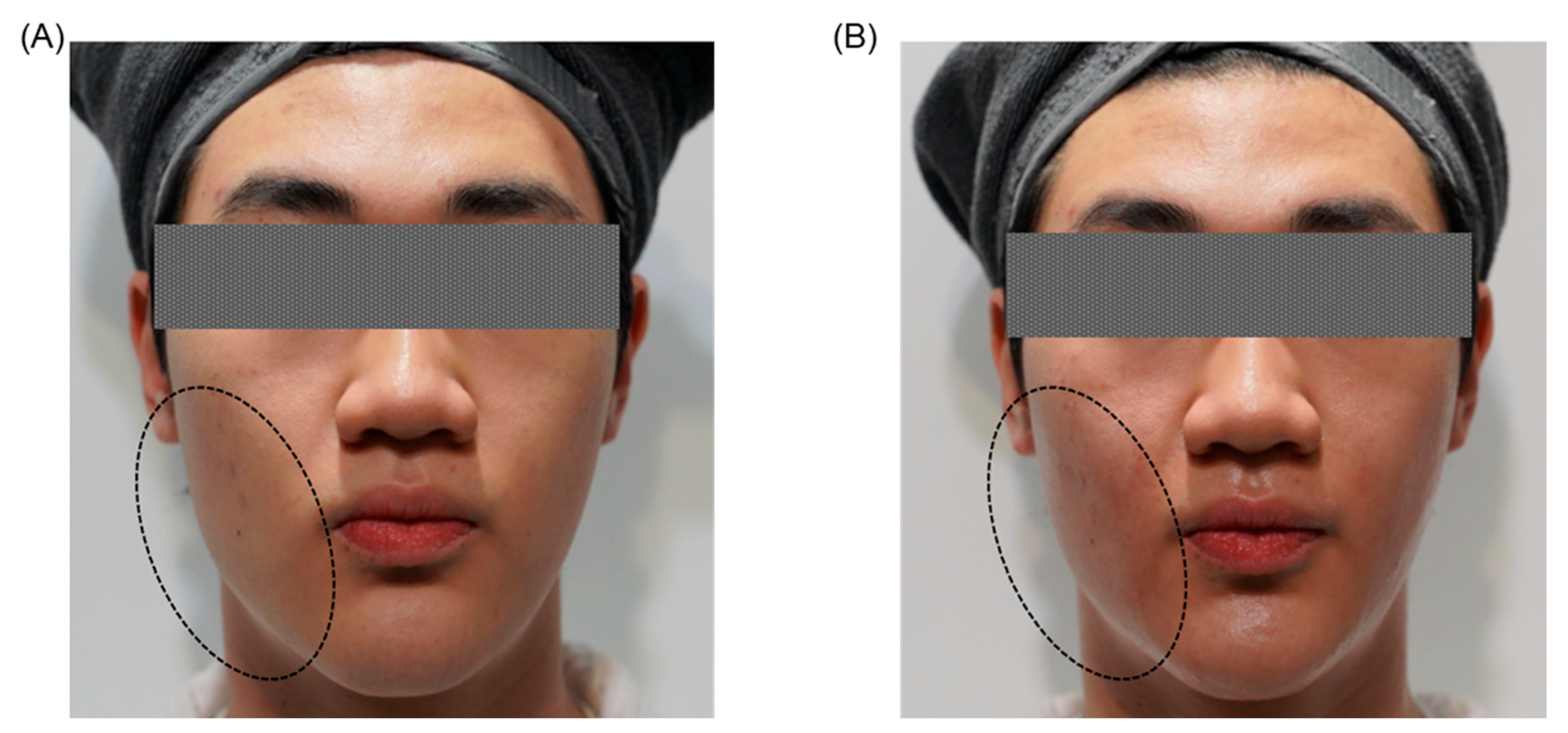 Jcm 14 08828 g003 Jcm 14 08828 g003