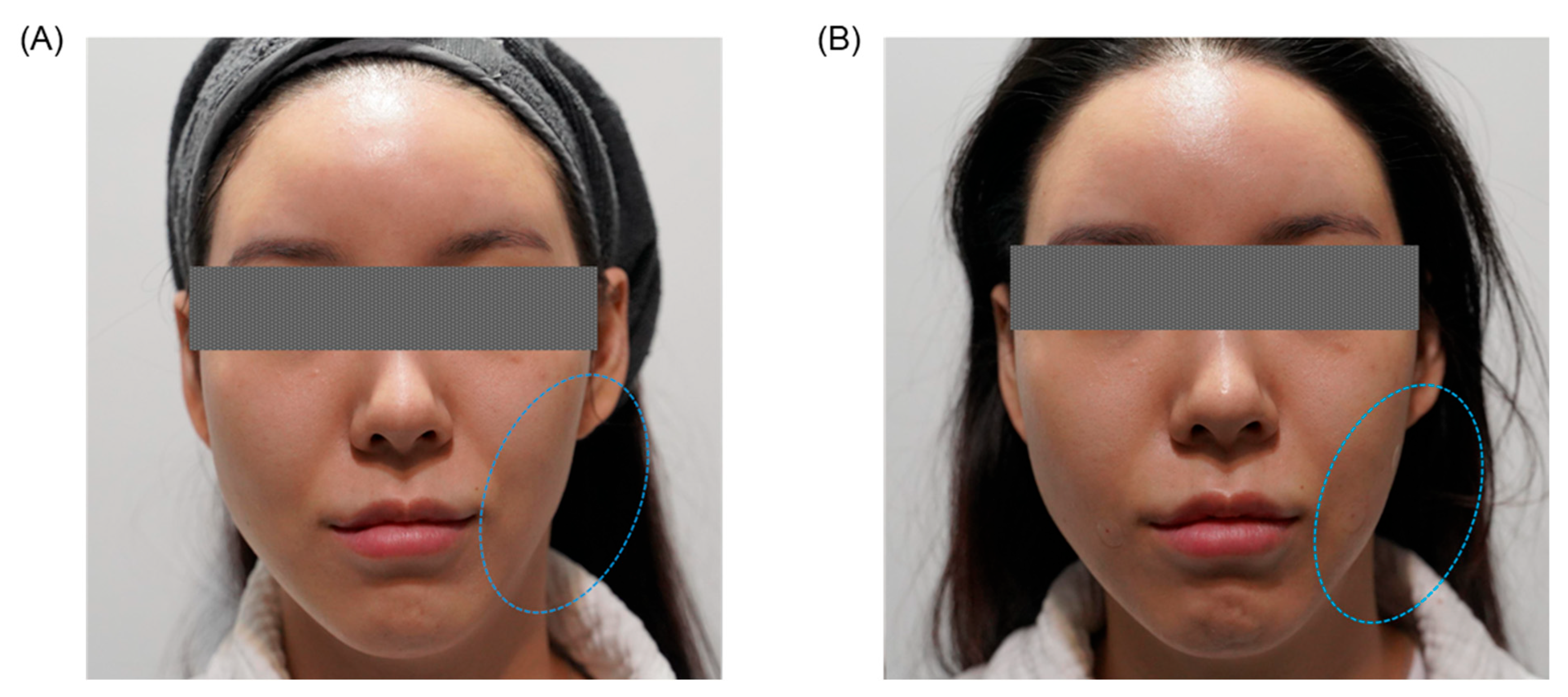 Jcm 14 08828 g004 Jcm 14 08828 g004