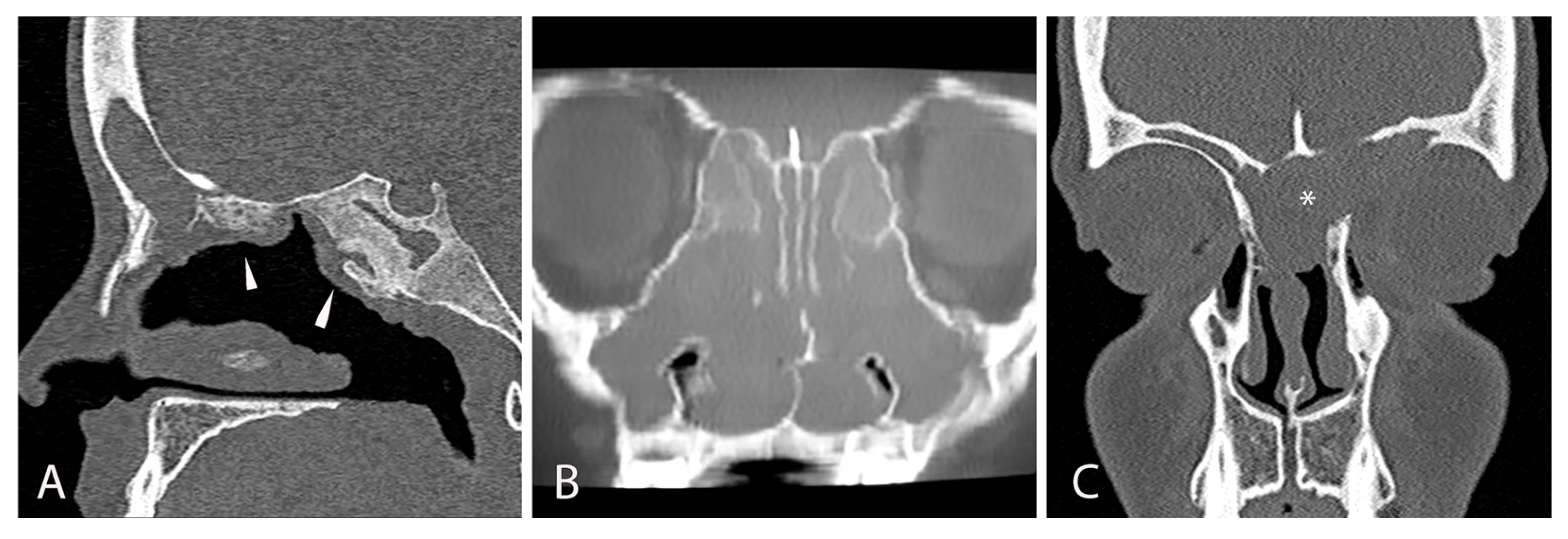 Jcm 14 08835 g002 Jcm 14 08835 g002