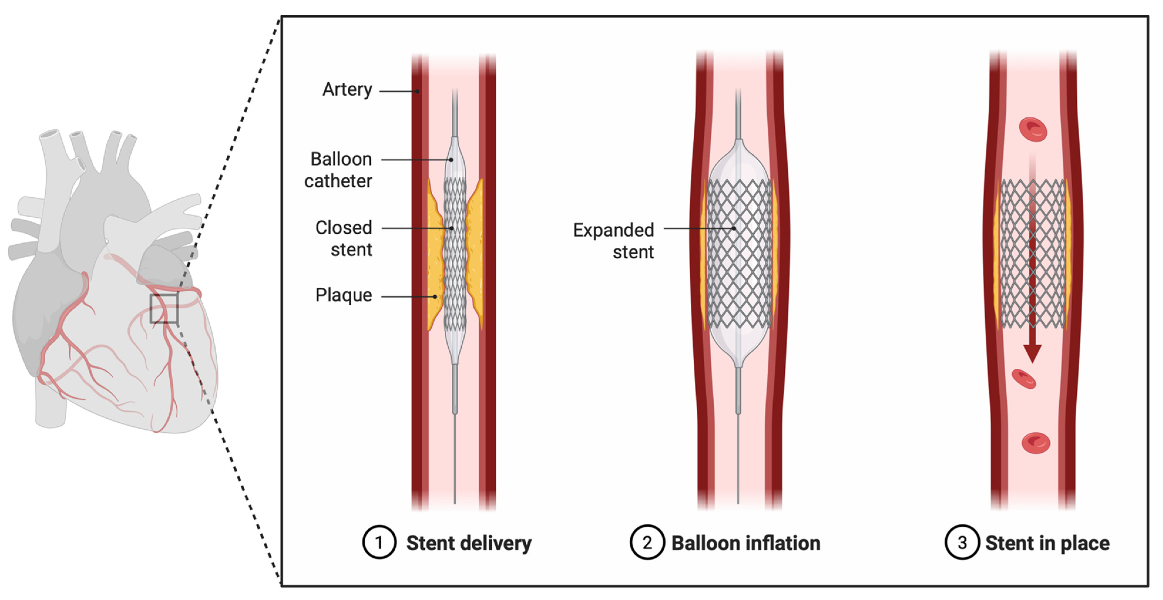 Jcm 14 08883 g001 Jcm 14 08883 g001