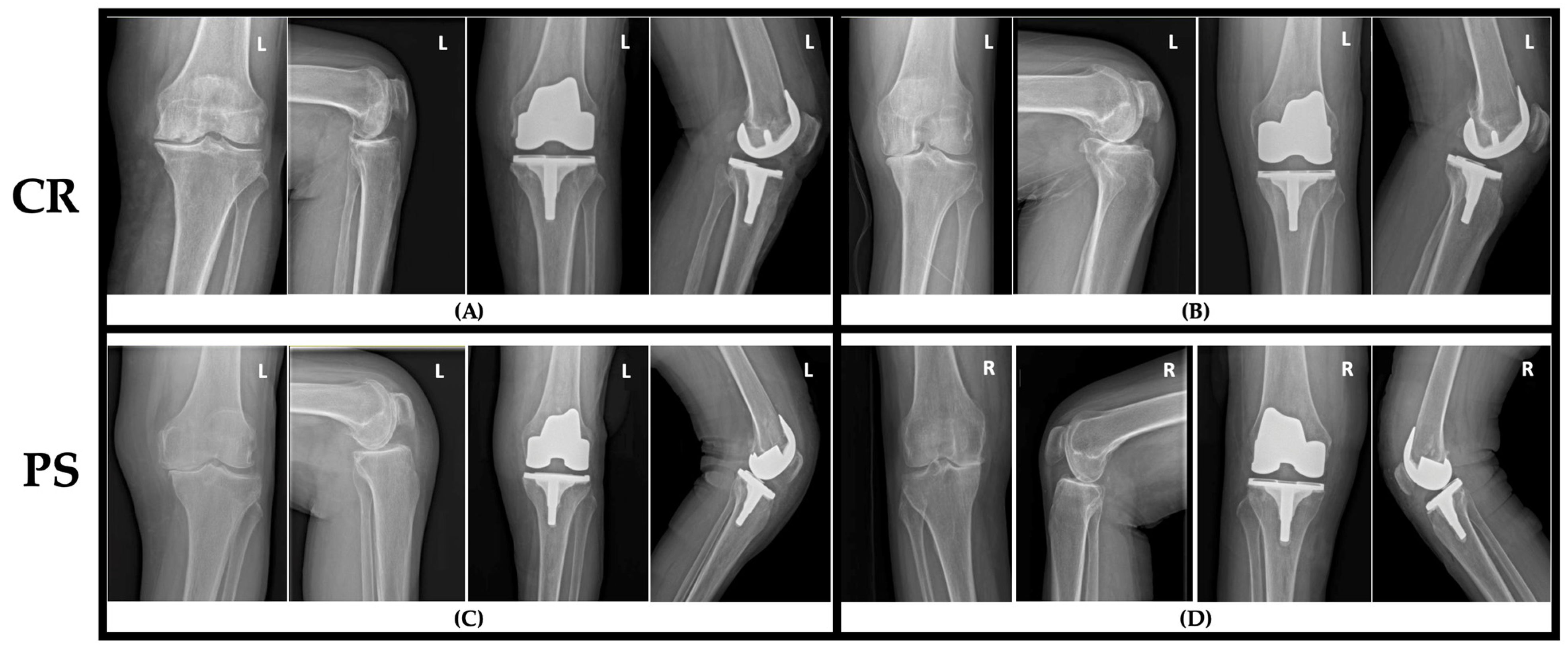 Jcm 14 08893 g002 Jcm 14 08893 g002