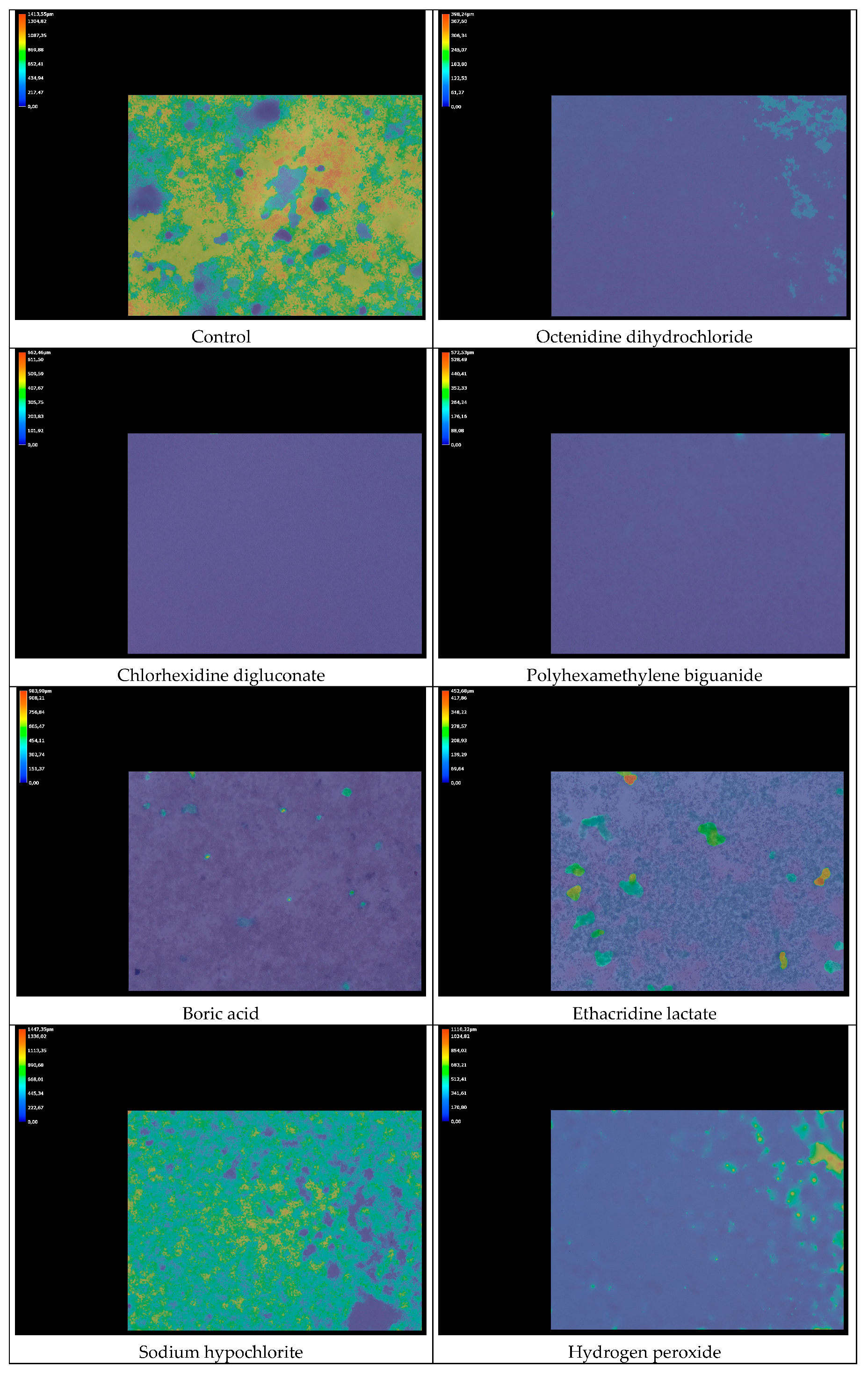 Jcm 14 08909 g004a Jcm 14 08909 g004a