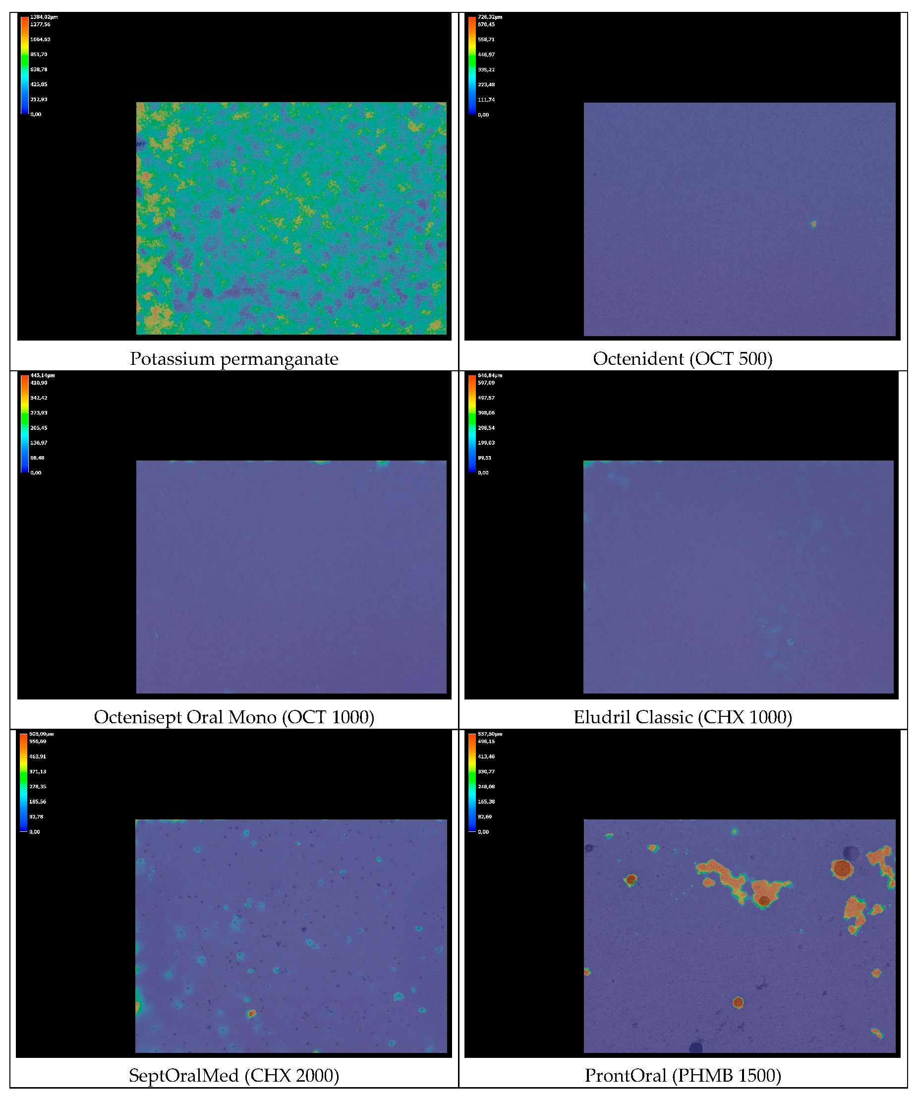 Jcm 14 08909 g004b Jcm 14 08909 g004b
