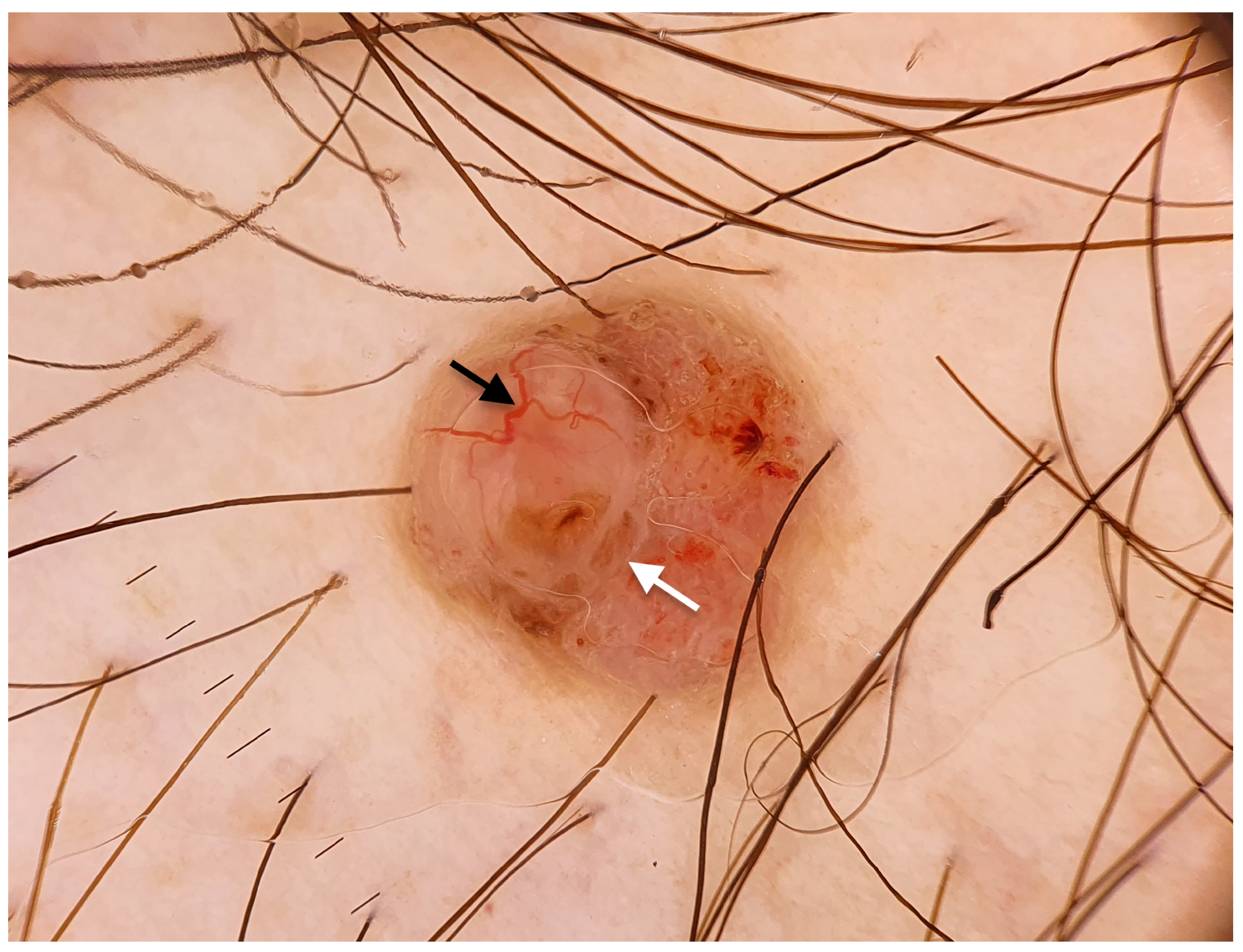 Jcm 14 08945 g002 Jcm 14 08945 g002