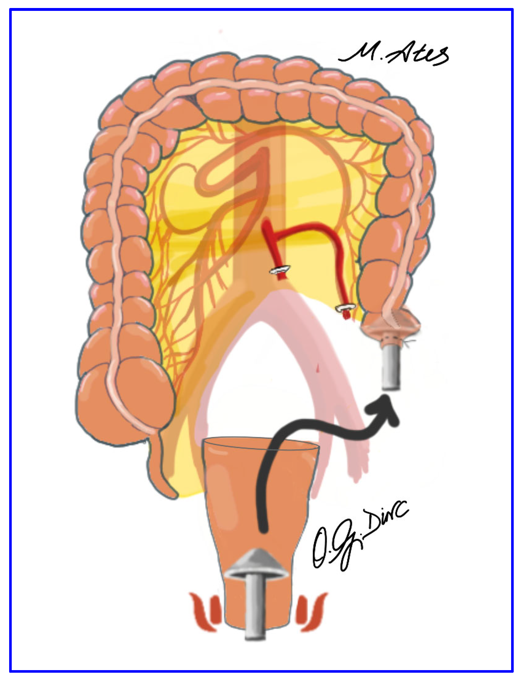 Jcm 15 00718 g004 Jcm 15 00718 g004