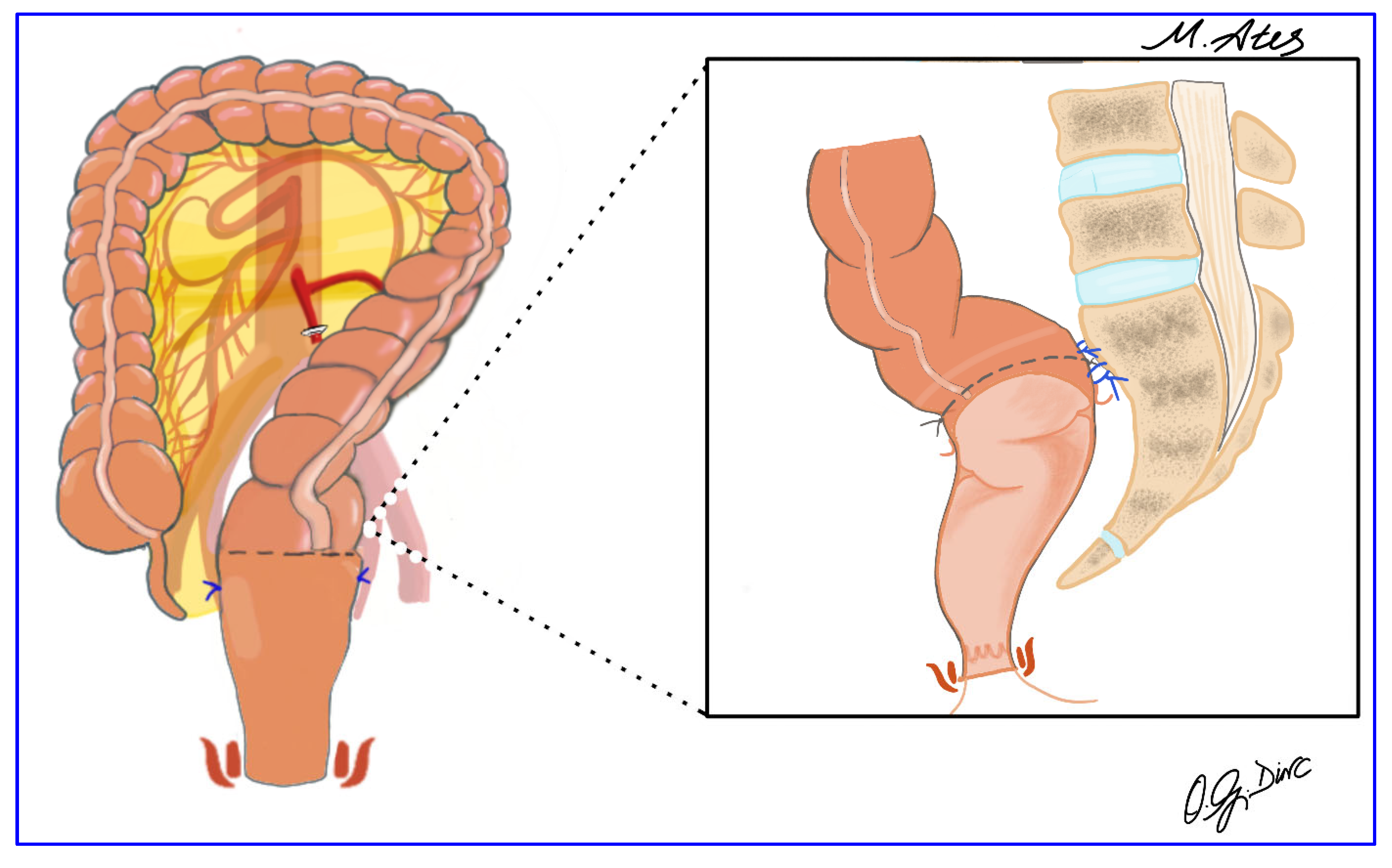 Jcm 15 00718 g006 Jcm 15 00718 g006