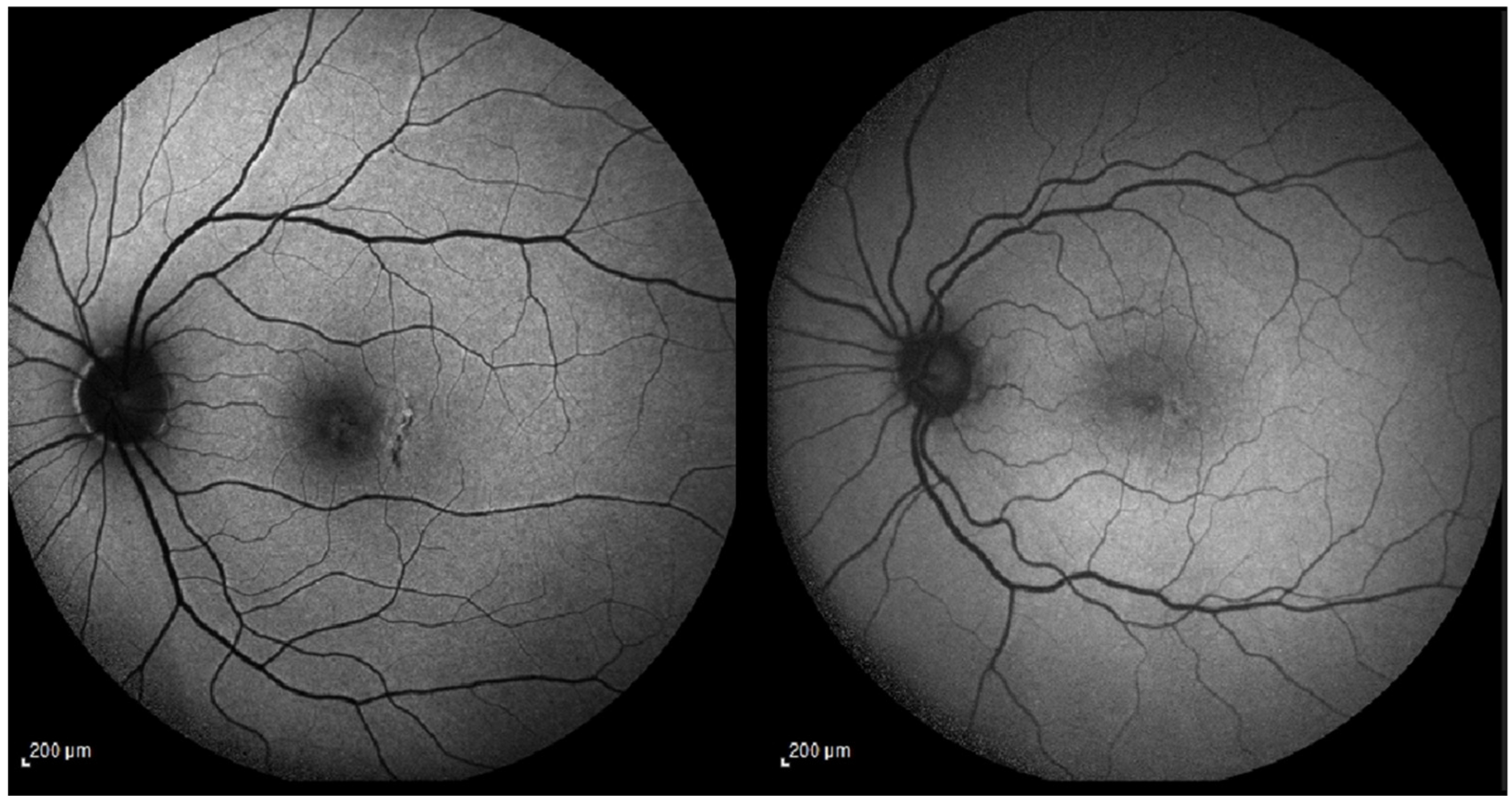 Jcm 15 00863 g001 Jcm 15 00863 g001