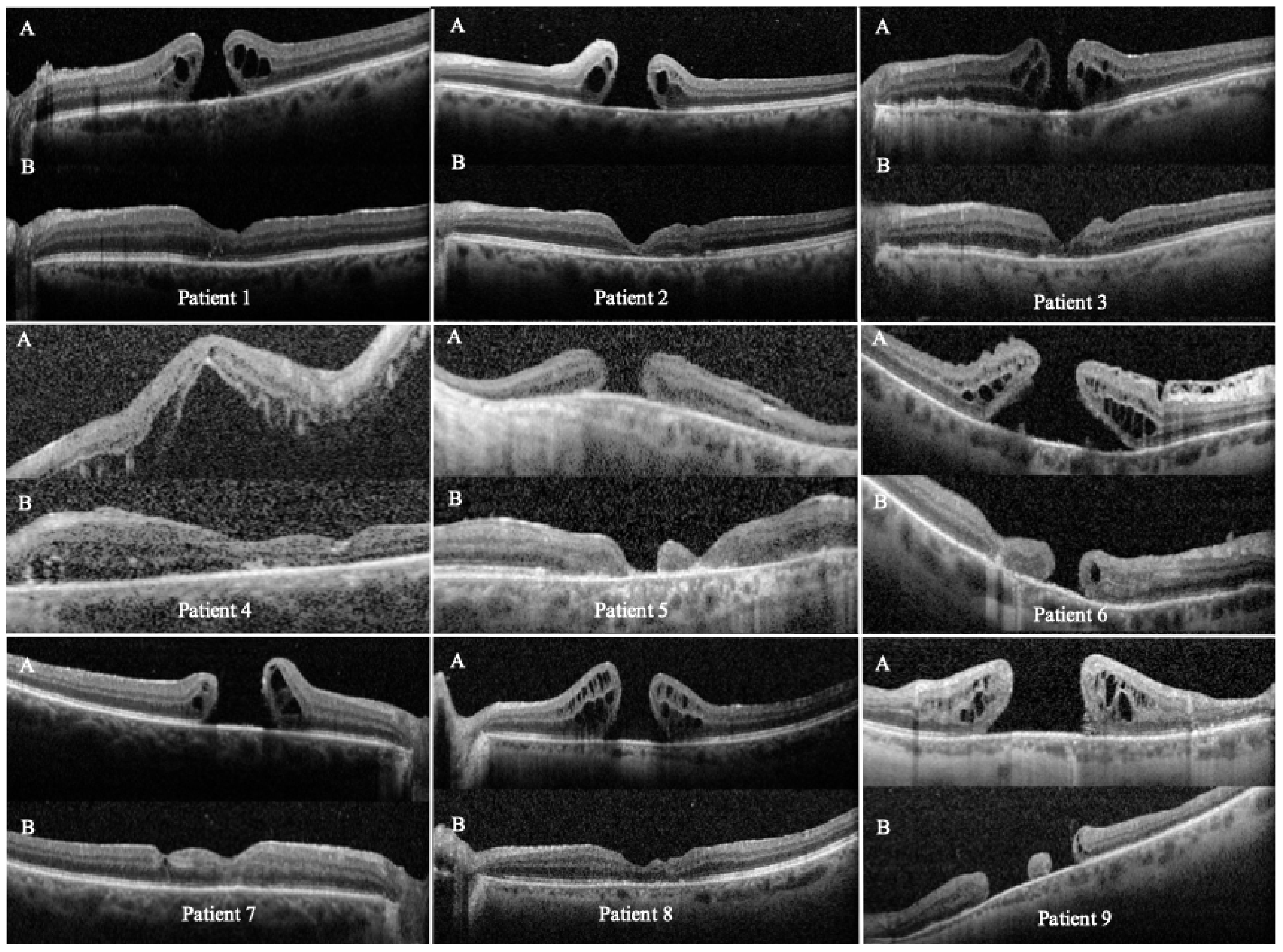Jcm 15 00863 g002 Jcm 15 00863 g002
