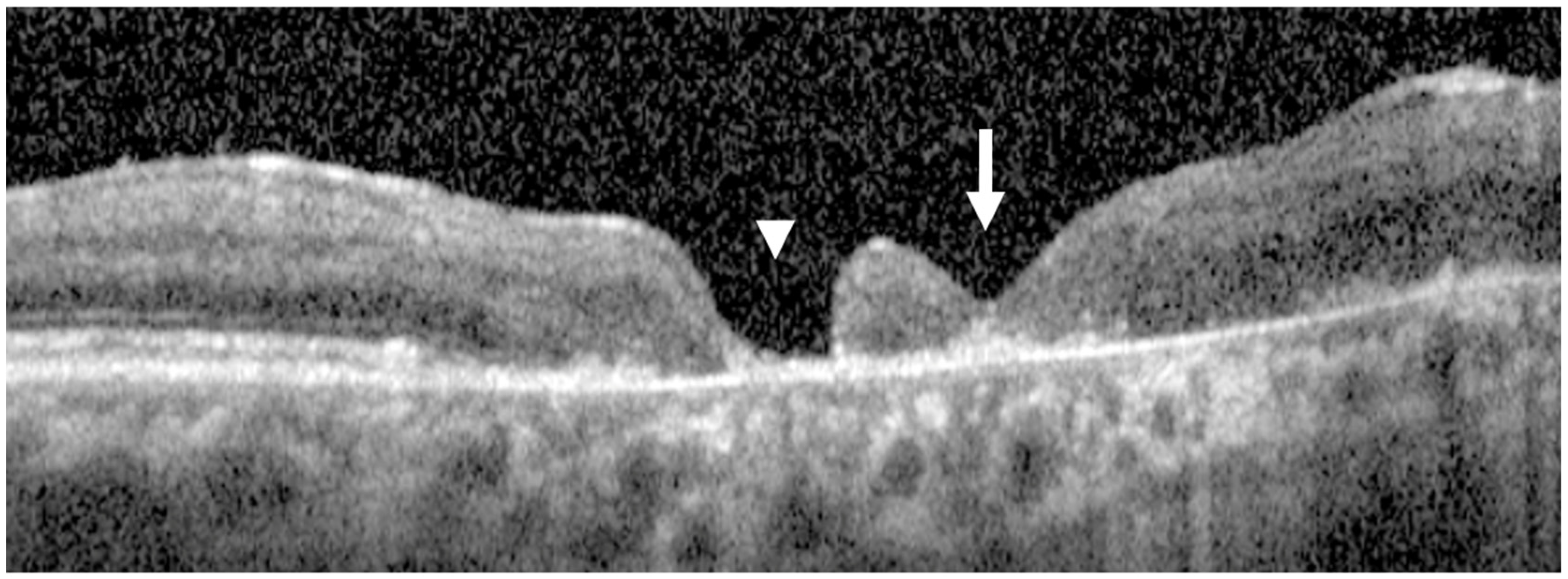 Jcm 15 00863 g005 Jcm 15 00863 g005