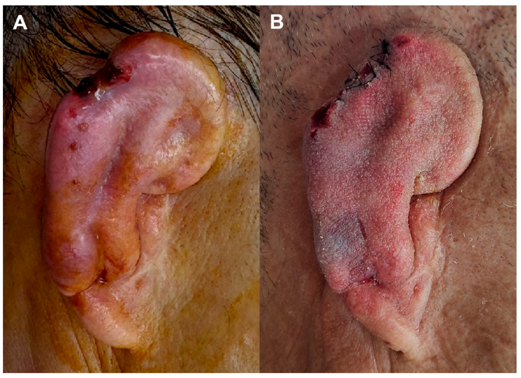 Jcm 15 01064 g004 Jcm 15 01064 g004