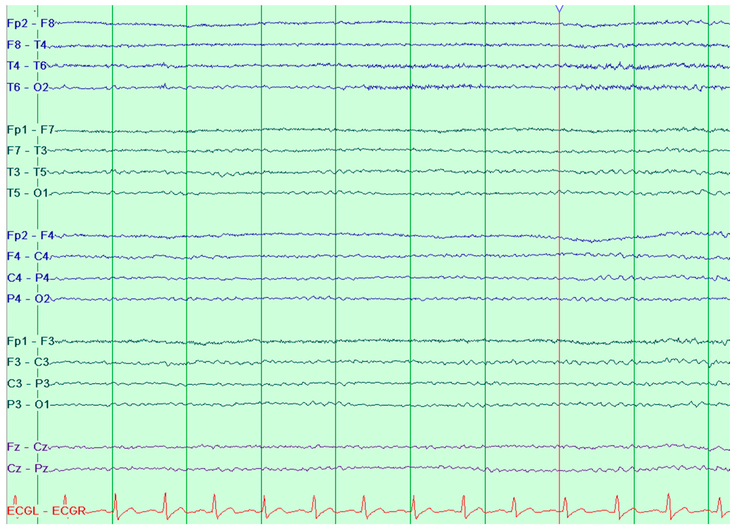 Jcm 15 01148 g004