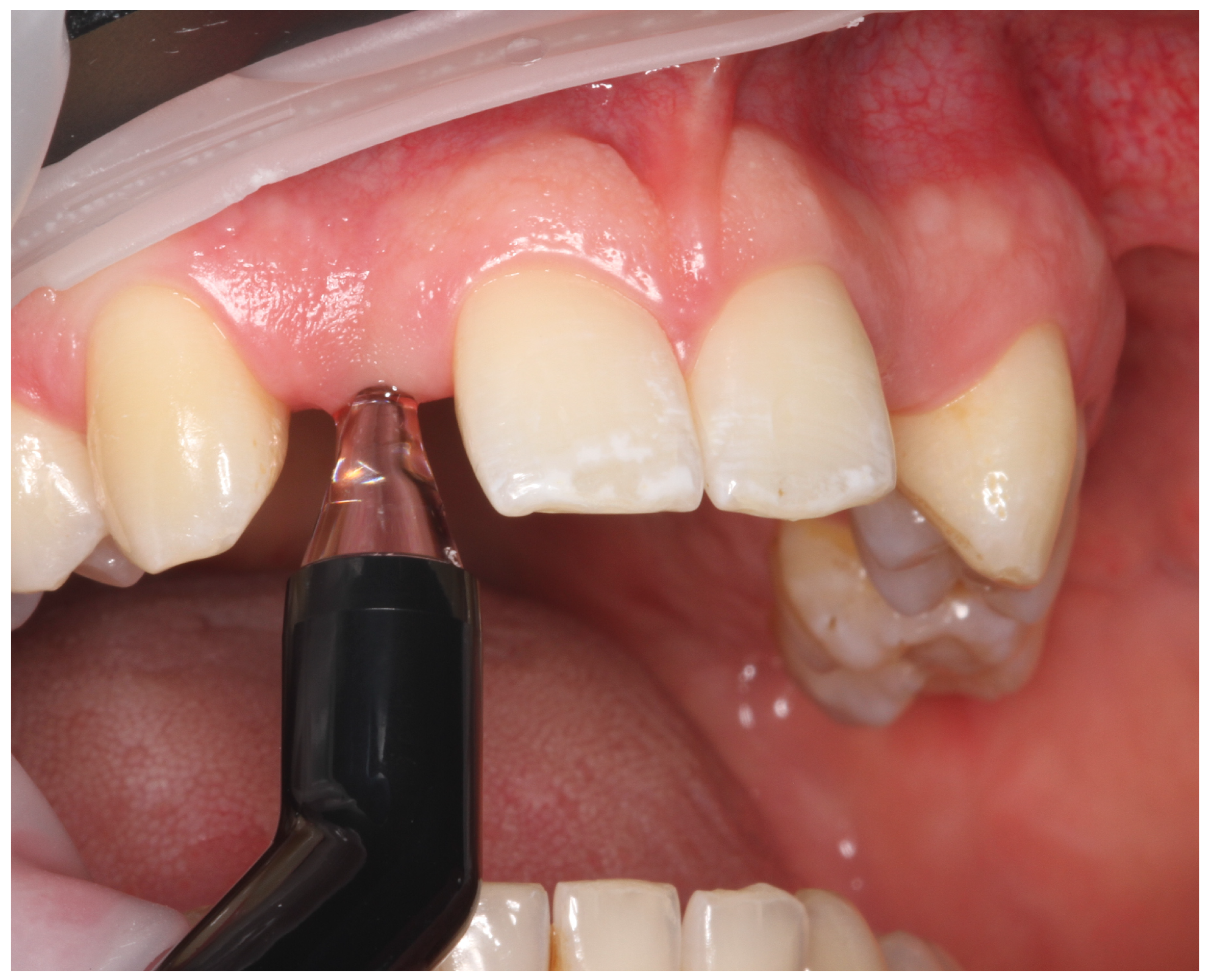 Jcm 15 01581 g003