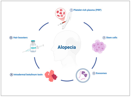 Advances in Medicalized Hair Loss Solutions: A Review of Current Clinical  Practices and Regenerative Medicine-Based Protocols with Focus on Off-Label  Injectable Treatments