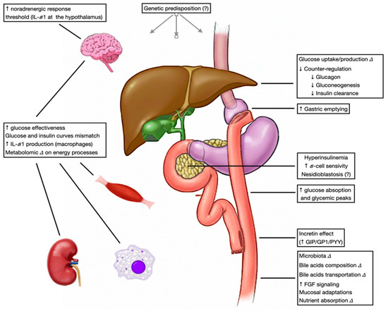 Post-Bariatric Hypoglycemia: Diagnosis, Mechanisms and ManagementA Case Report-Based Review Post-Bariatric Hypoglycemia: Diagnosis, Mechanisms and ManagementA Case Report-Based Review