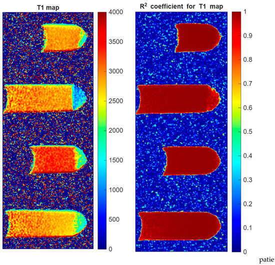 Atherosclerotic Plaque Characterization Magnetic Resonance Imaging