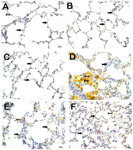 Rosuvastatin Attenuates Pulmonary Damage in Rats with Cecal Ligation and Puncture-Induced Sepsis