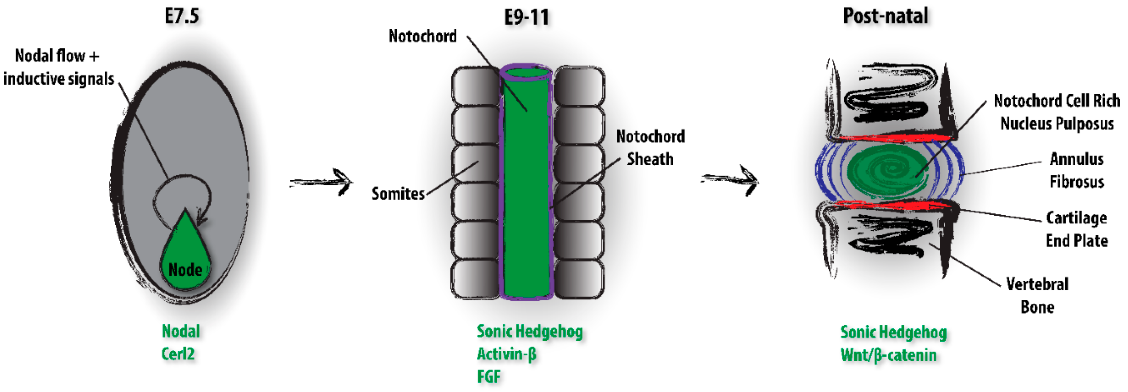 JDB Free Full Text Notochord  Cells in Intervertebral 