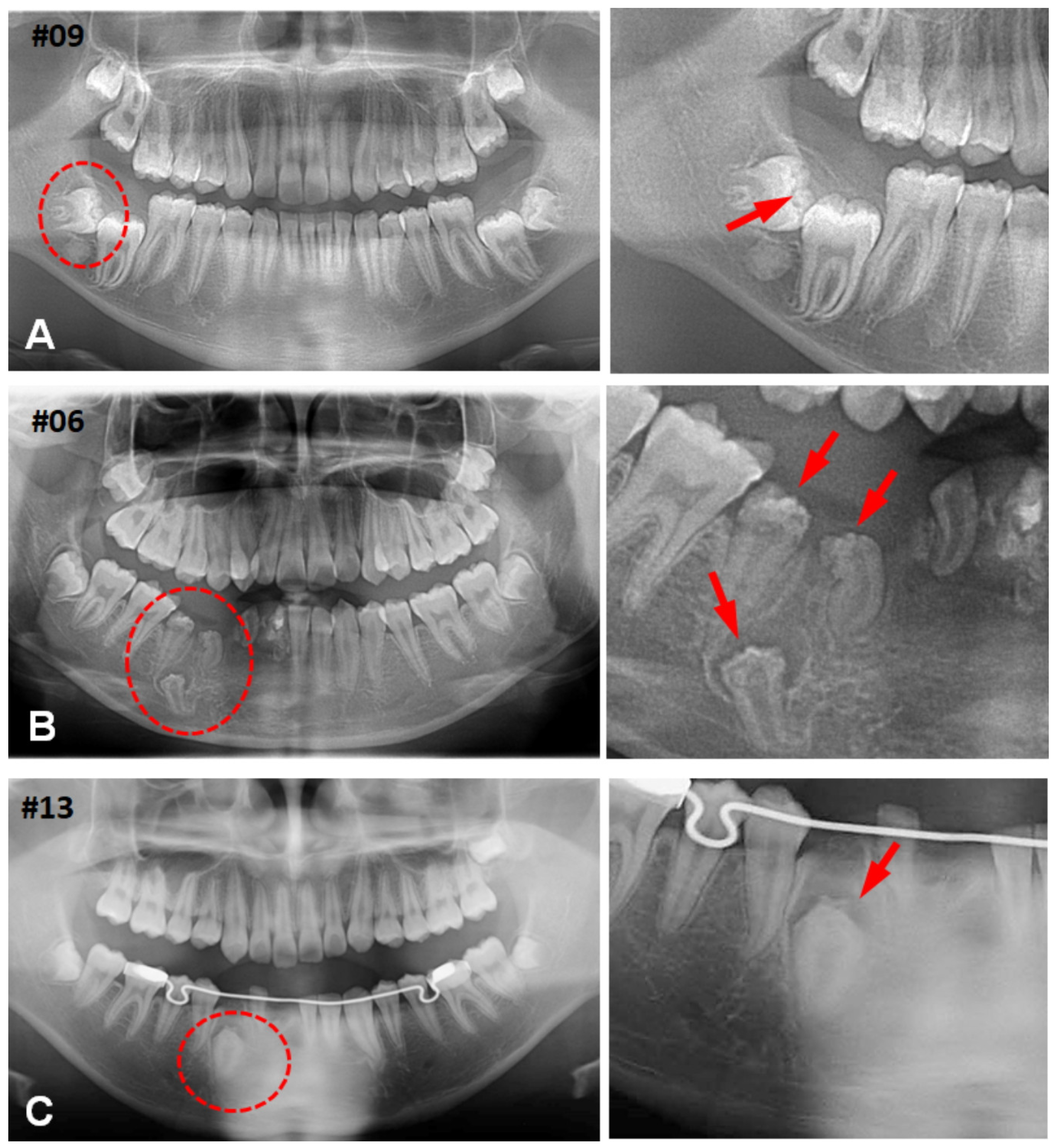 Jdb 12 00007 g001 Jdb 12 00007 g001
