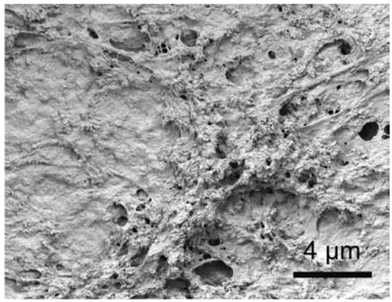 Calcium Orthophosphate-Containing Biocomposites and Hybrid