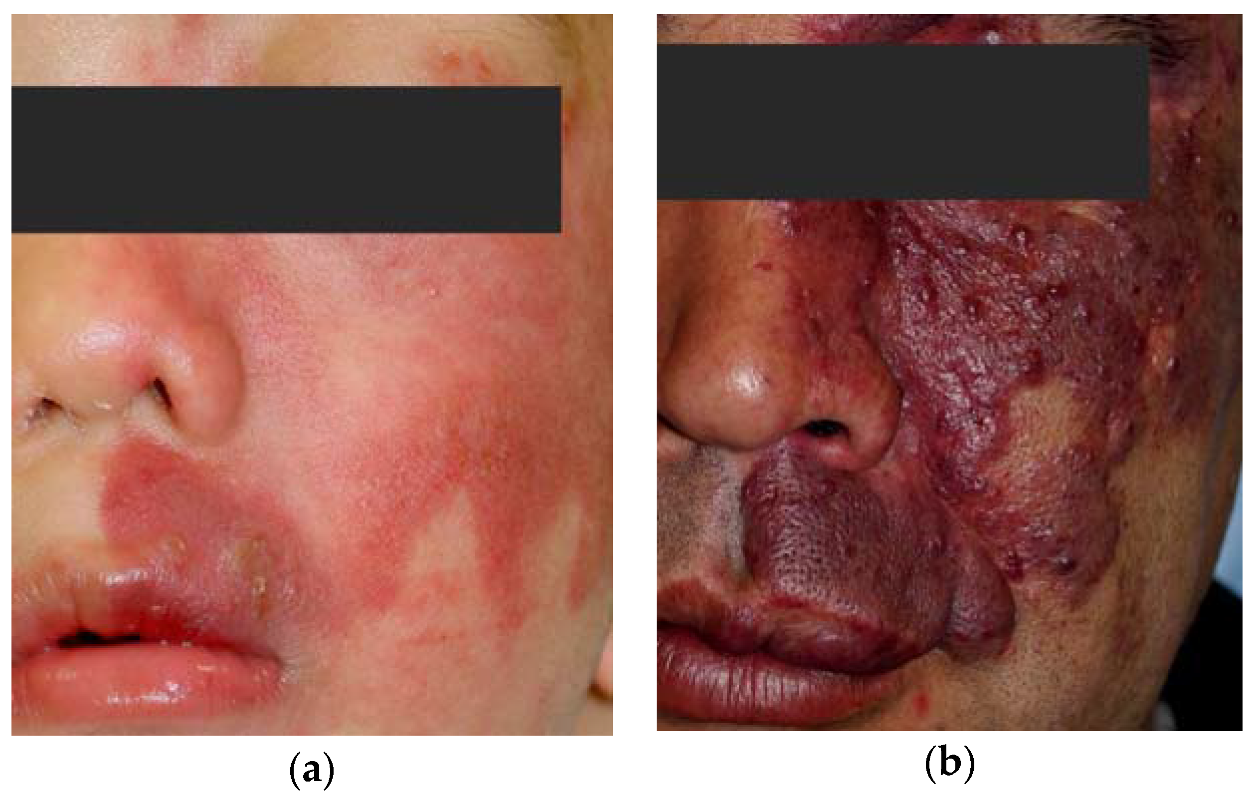 Jfb 08 00014 g002 550