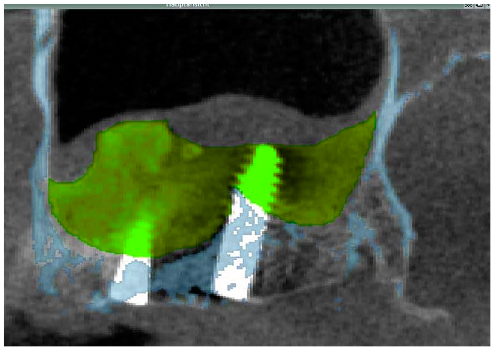 Jfb 08 00031 g002 550