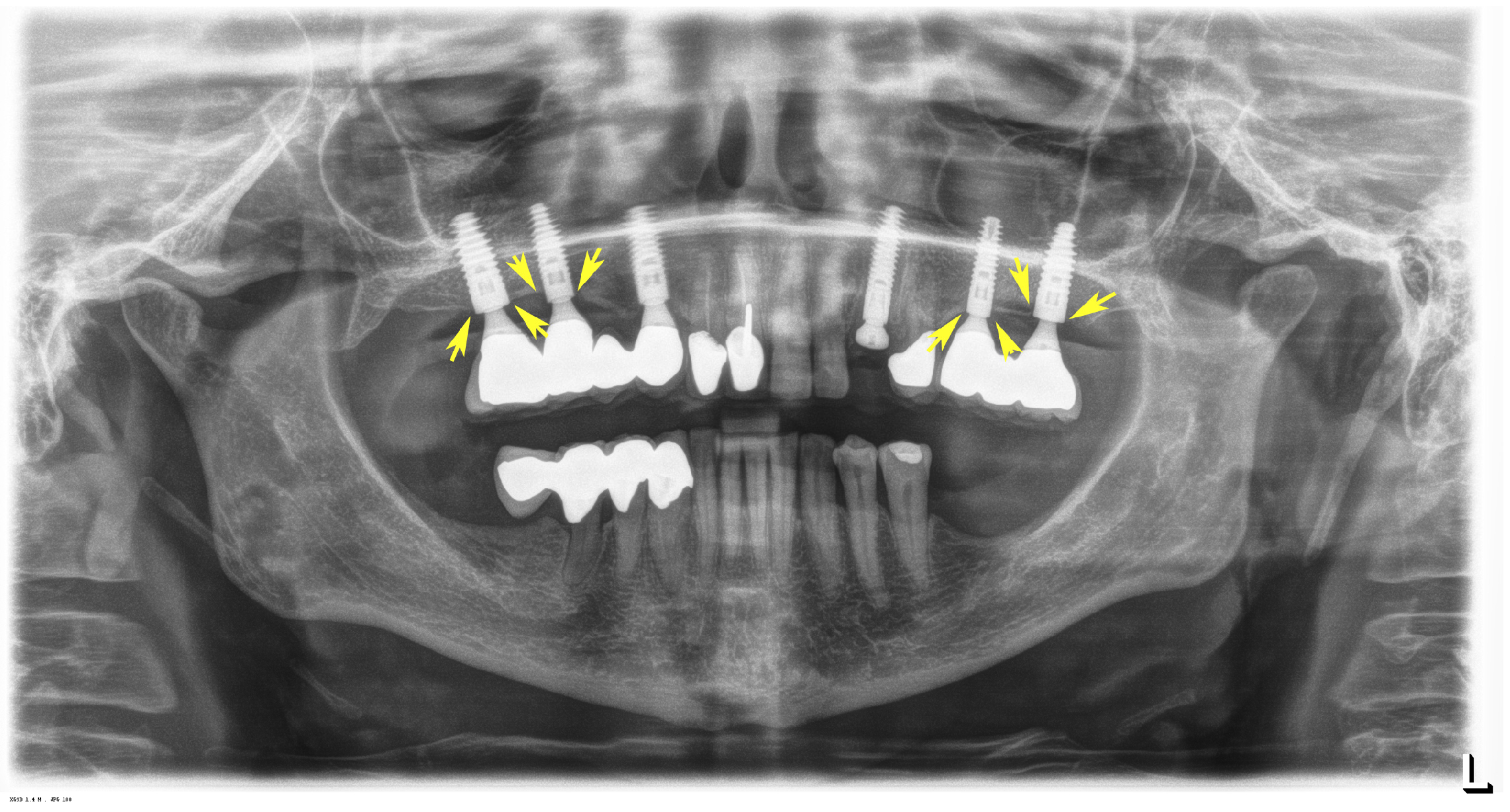 Jfb 08 00031 g010 550