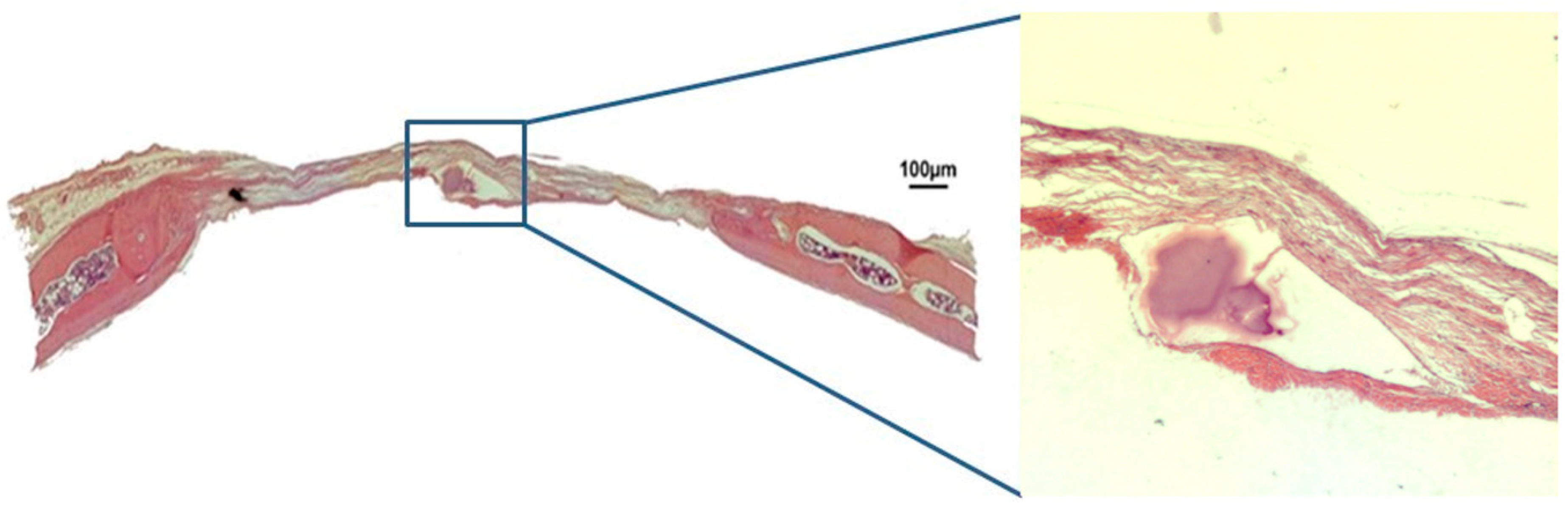 Jfb 10 00021 g005 Jfb 10 00021 g005